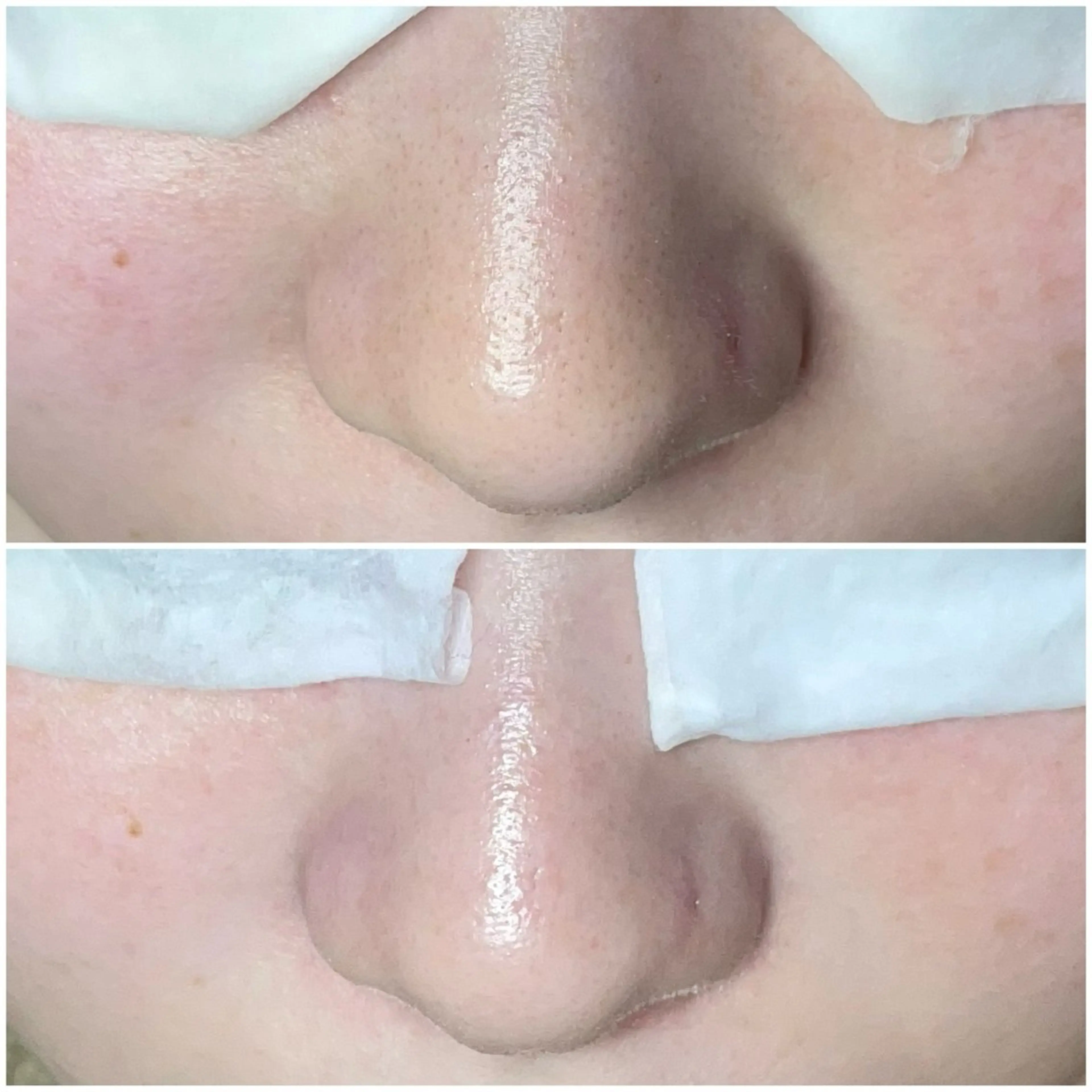 エステ Re:Belle 久留米 : 中島のエステ・リラクイメージ