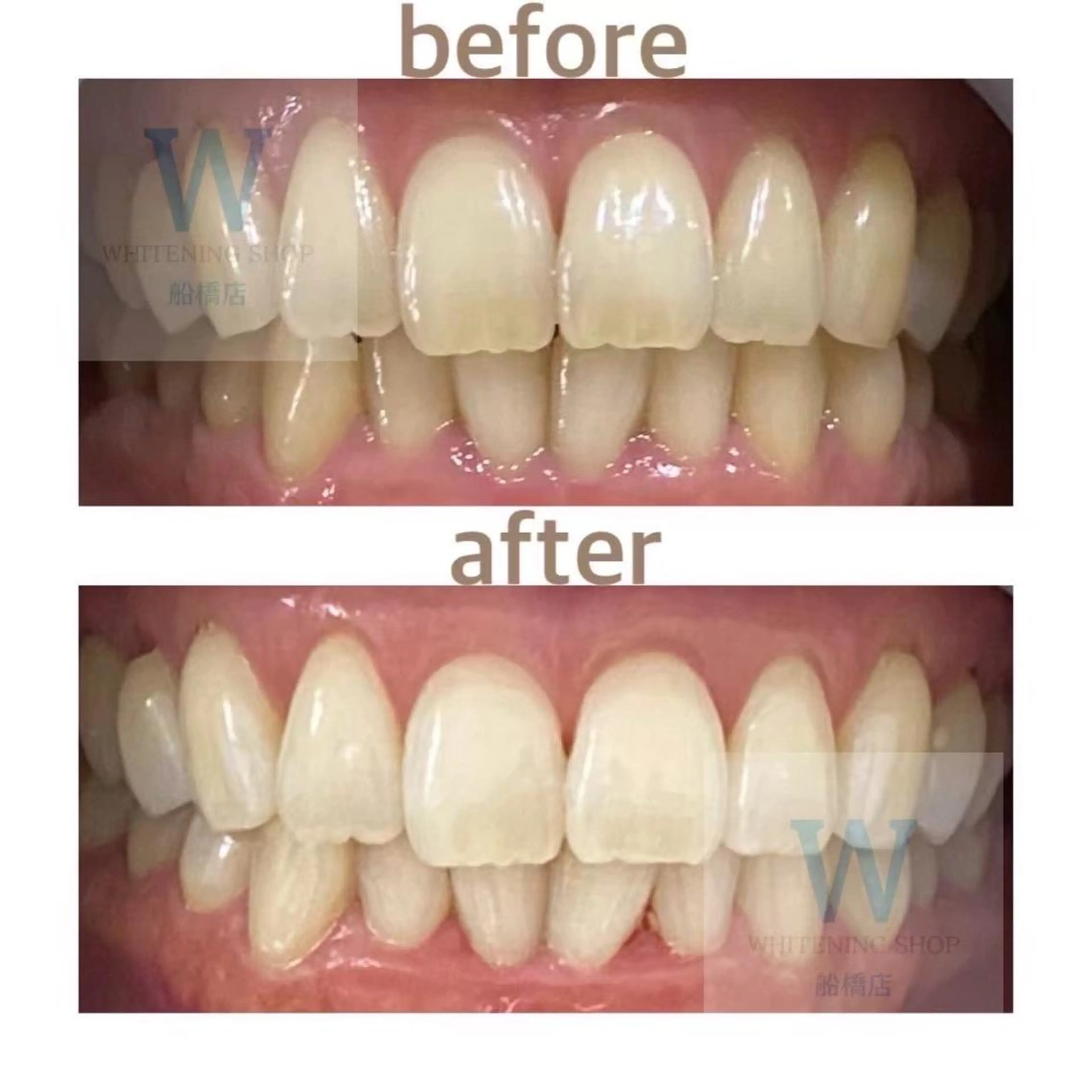 ホワイトニング ショップ船橋２号店のエステ・リラクイメージ