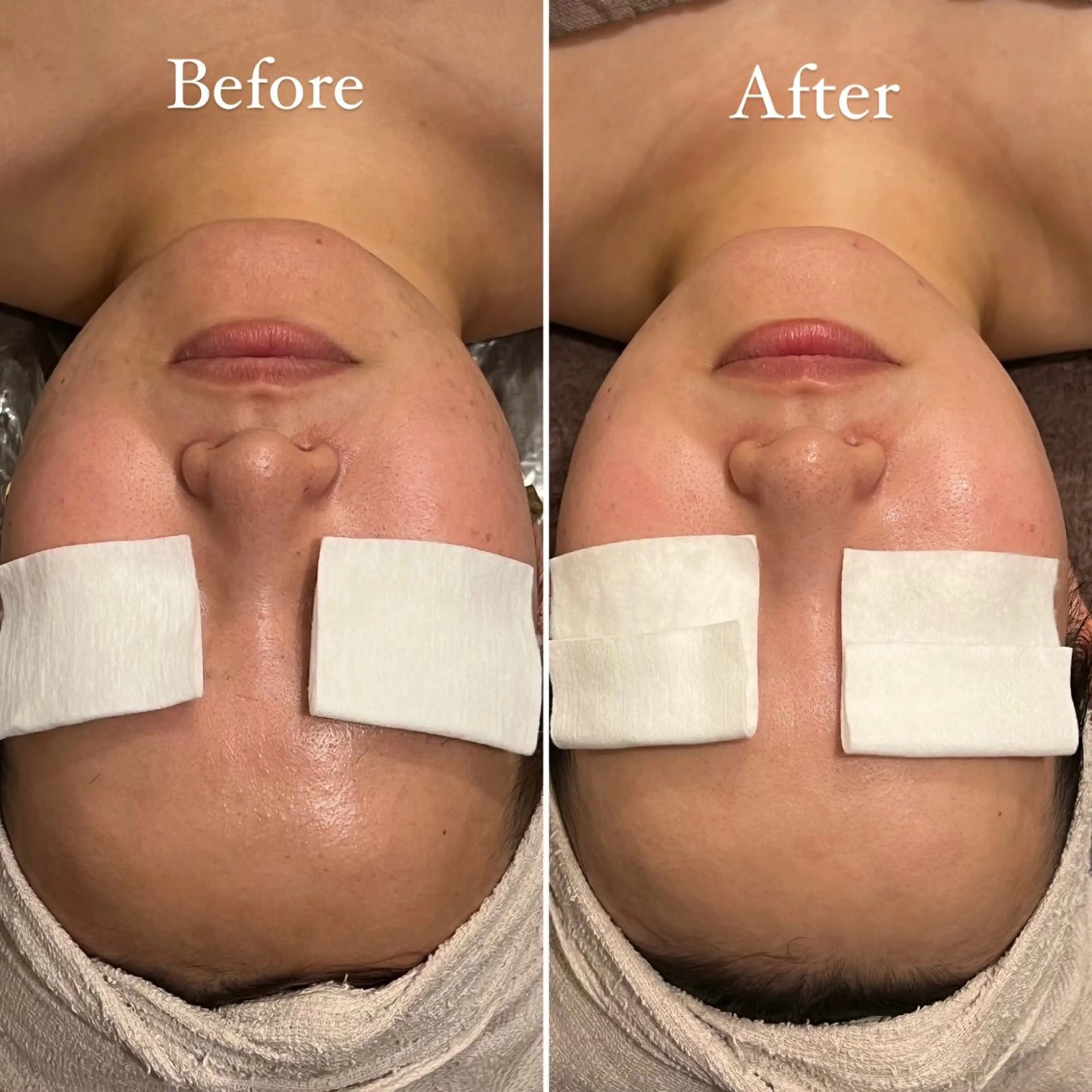 Tulipe Chihoのエステ・リラクイメージ