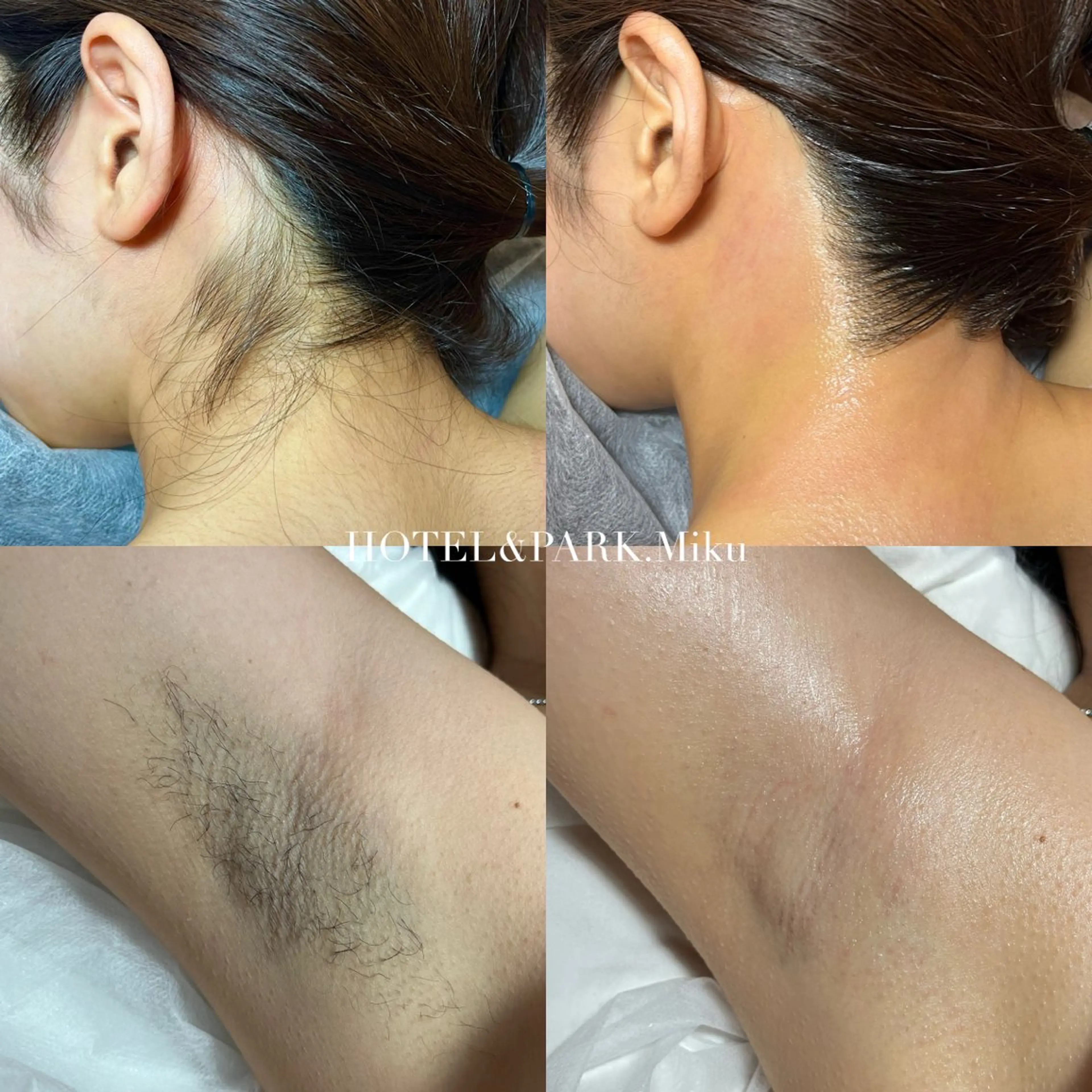 HOTEL&PARK Mikuワックス脱毛のエステ・リラクイメージ