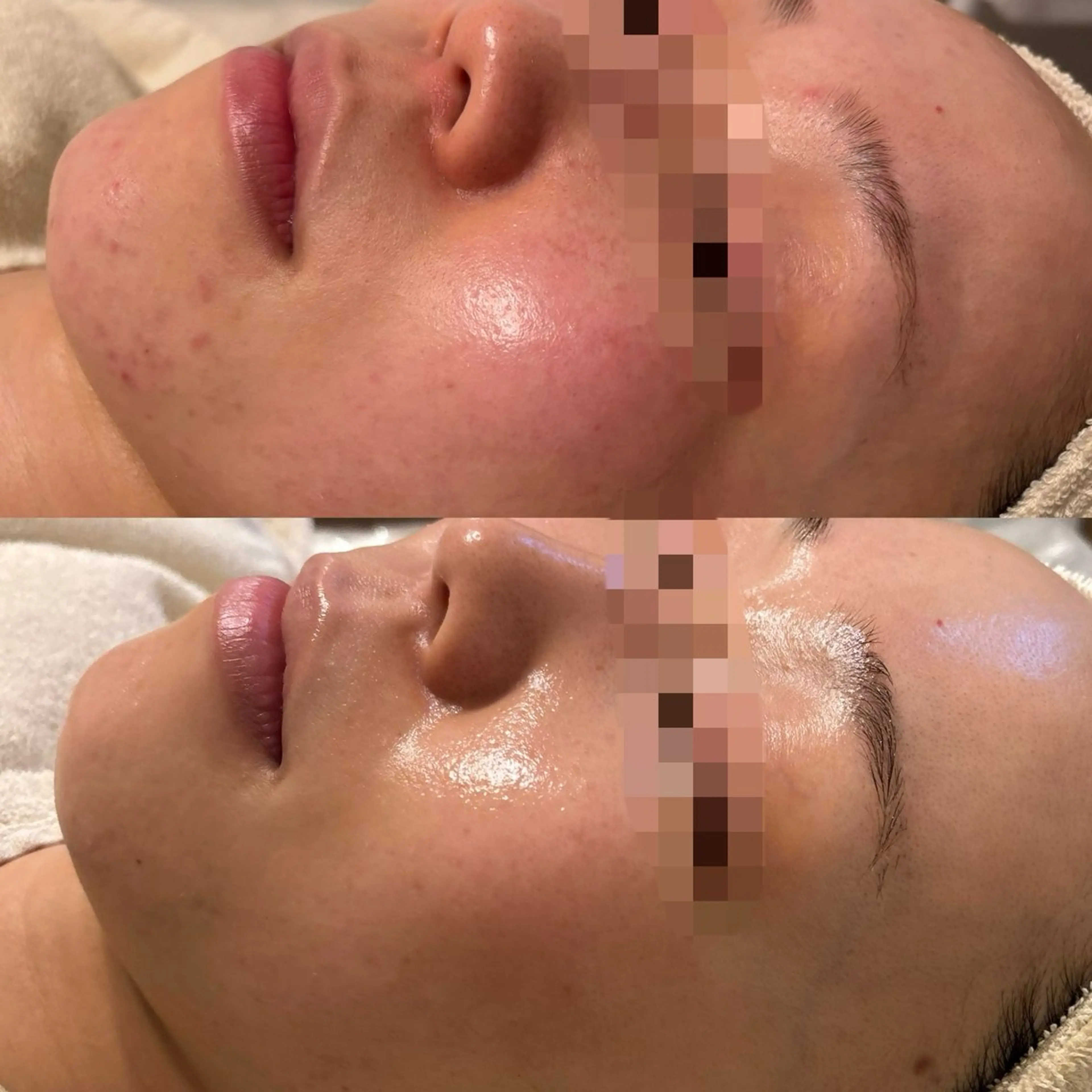 【小顔・肌荒れ】オールハンド美肌スペシャルケアの写真