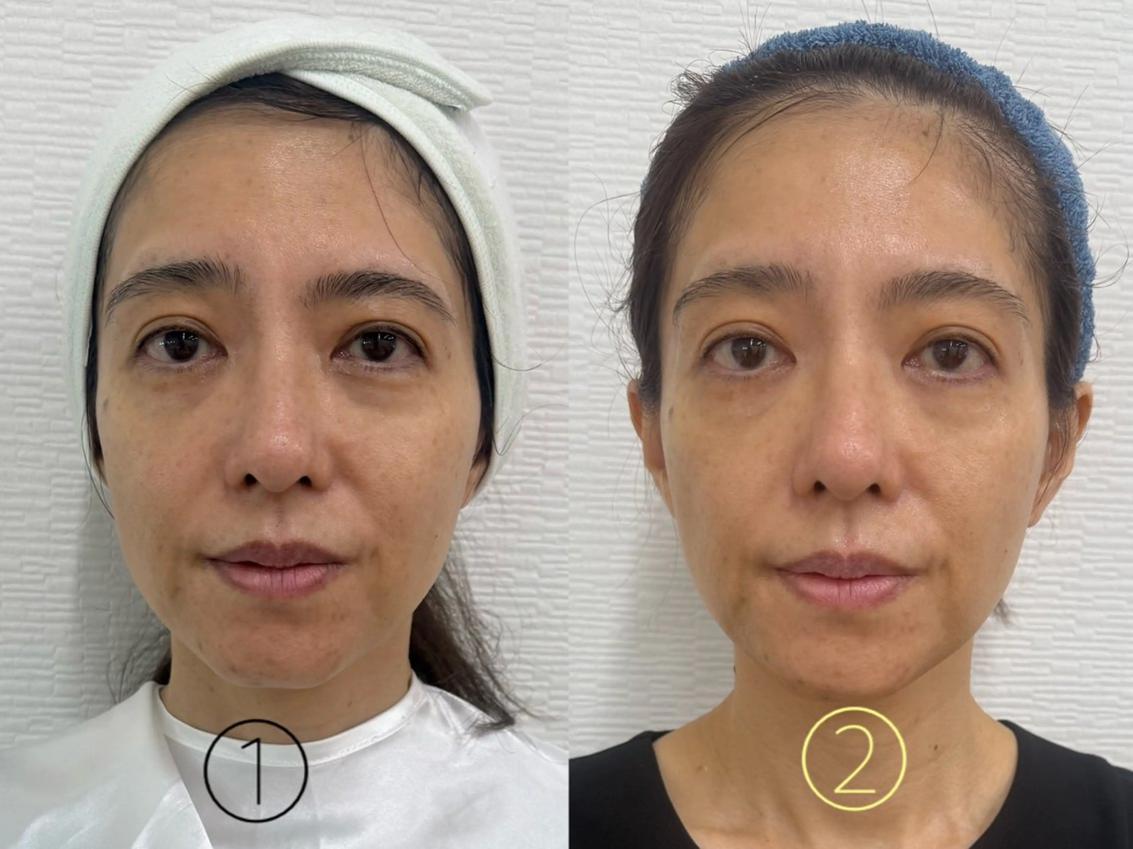 e-Reju イリュージュのネイルデザイン