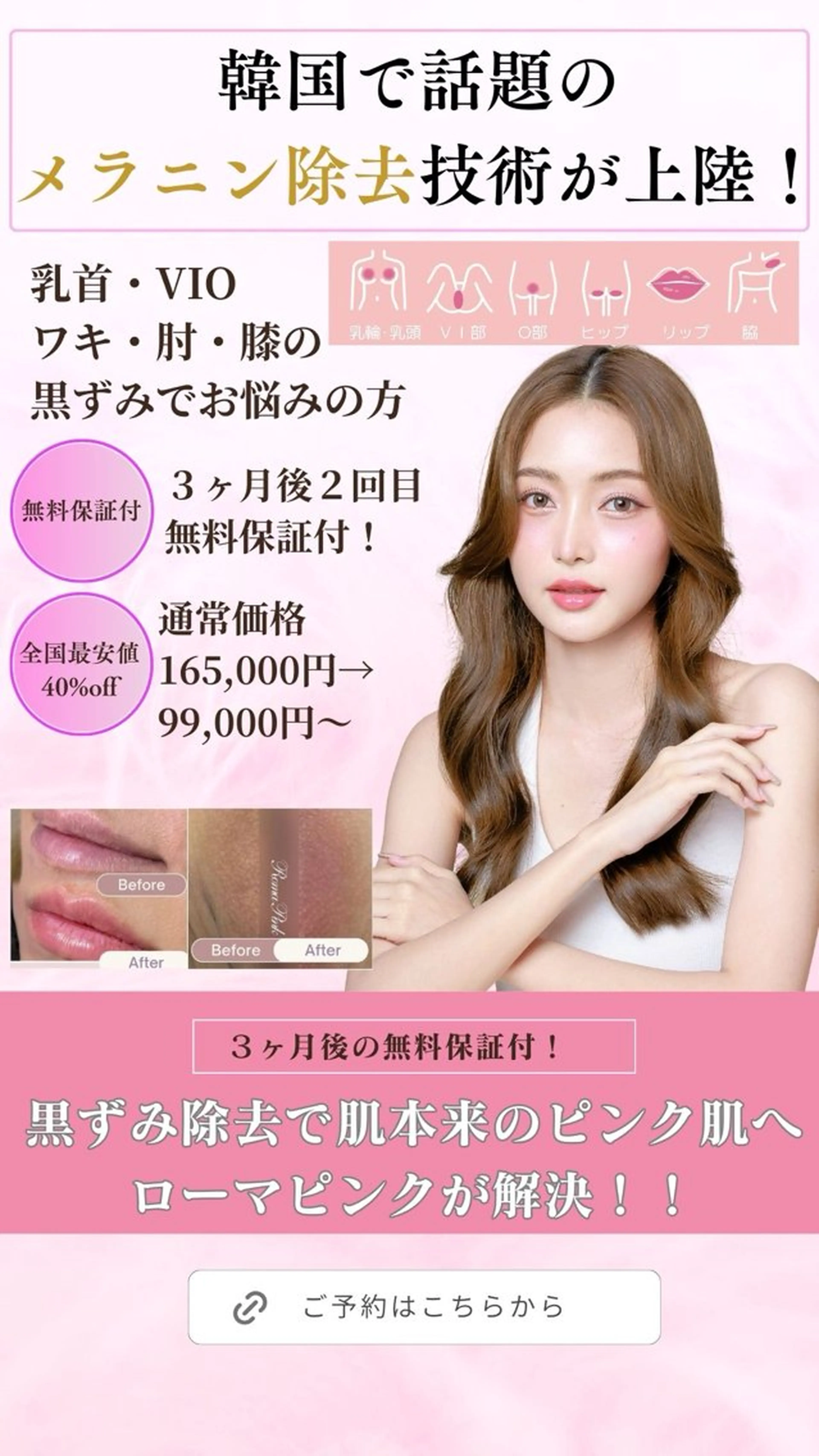 ローマピンク相談の写真