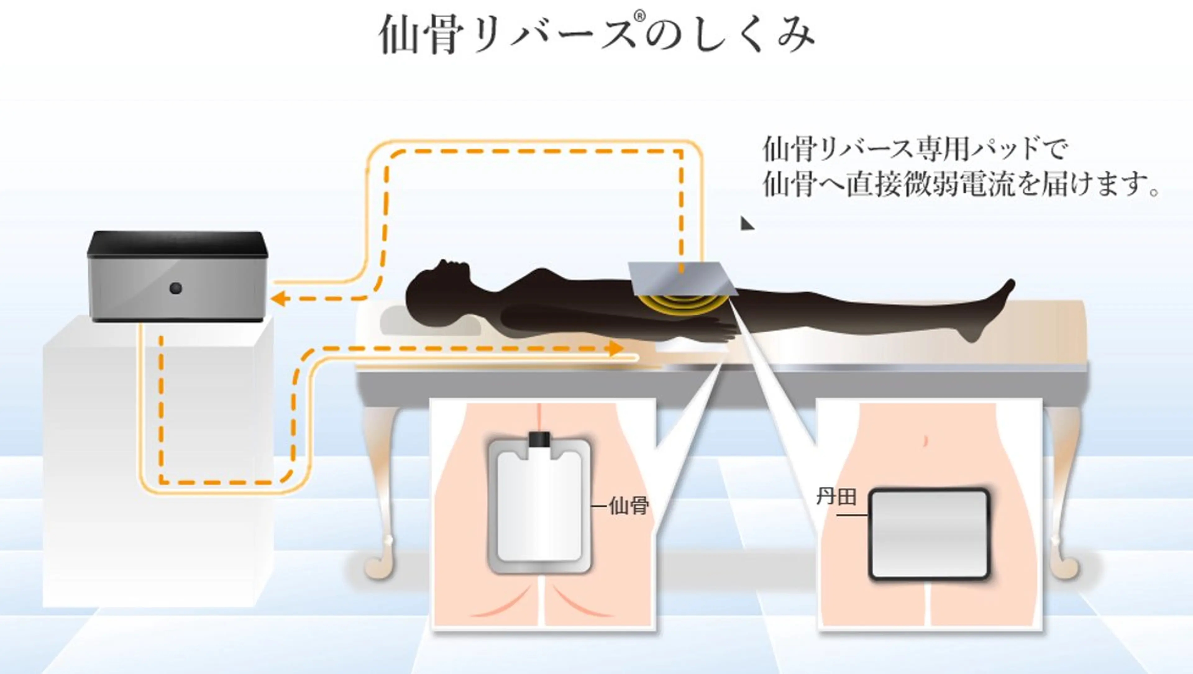 仙骨セルフメンテナンスの写真