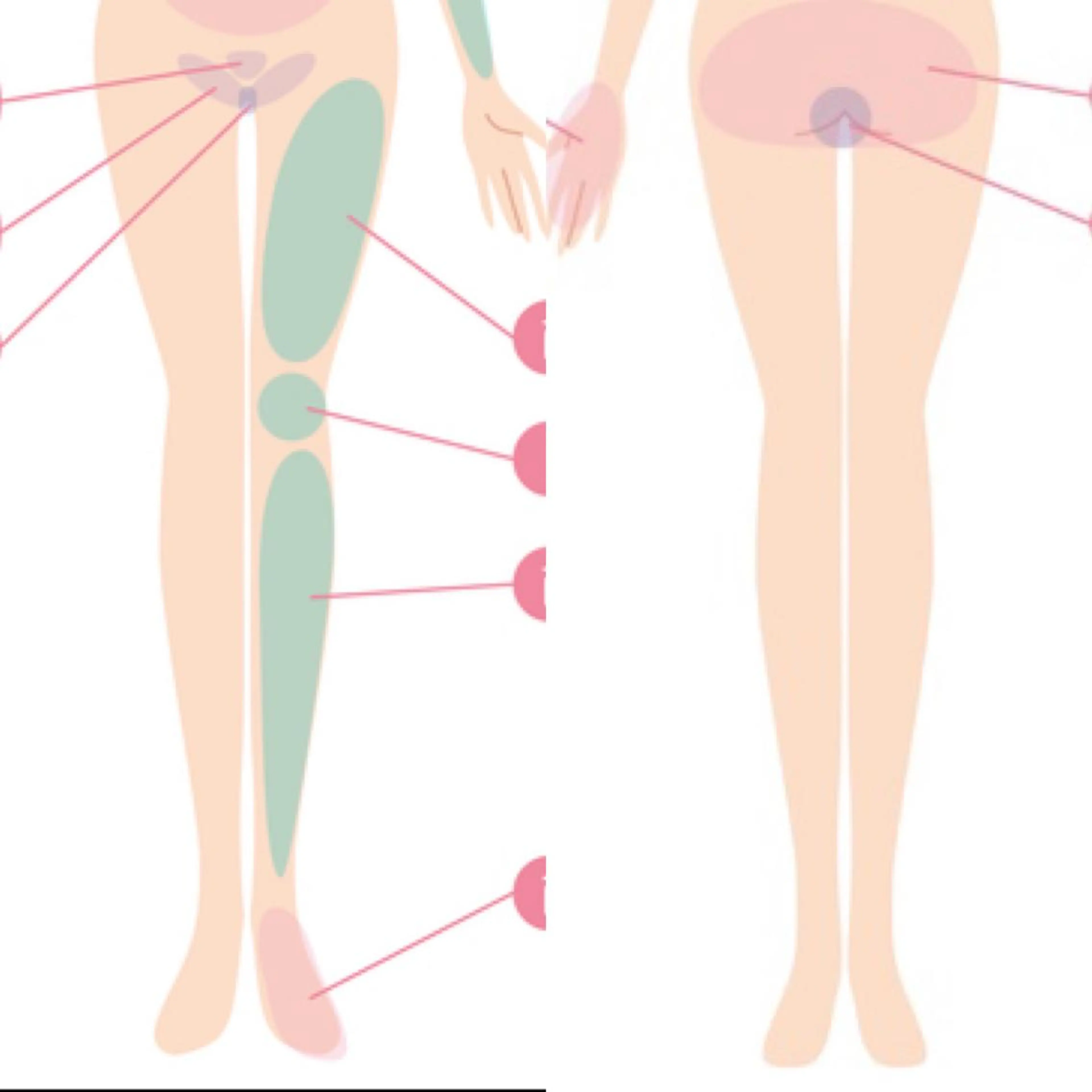 🚺【女性脱毛】下半身(両面)ＶＩＯ込みの写真