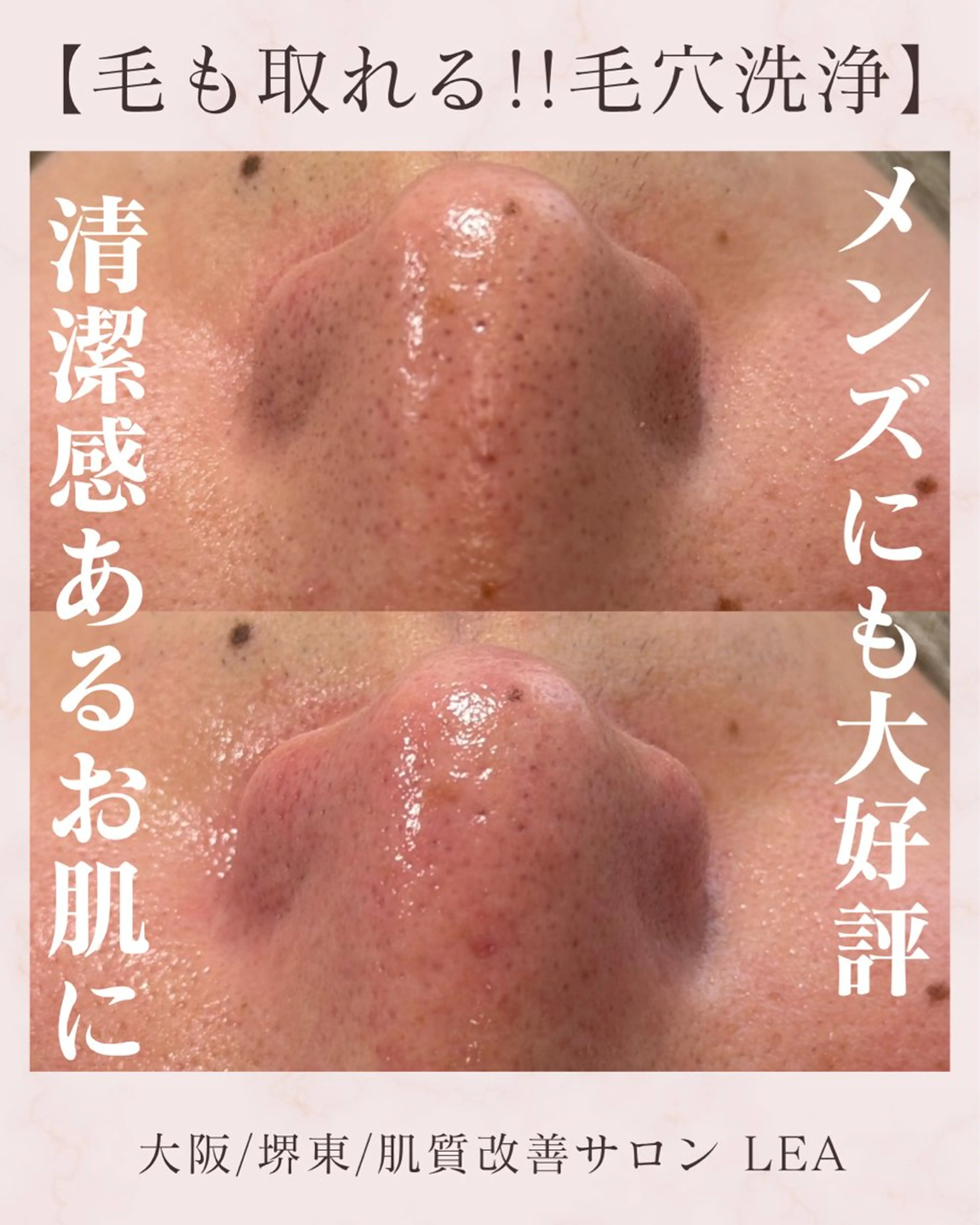 エステ Lea堺東　毛穴洗浄 ×顔ワックス脱毛のその他イメージ