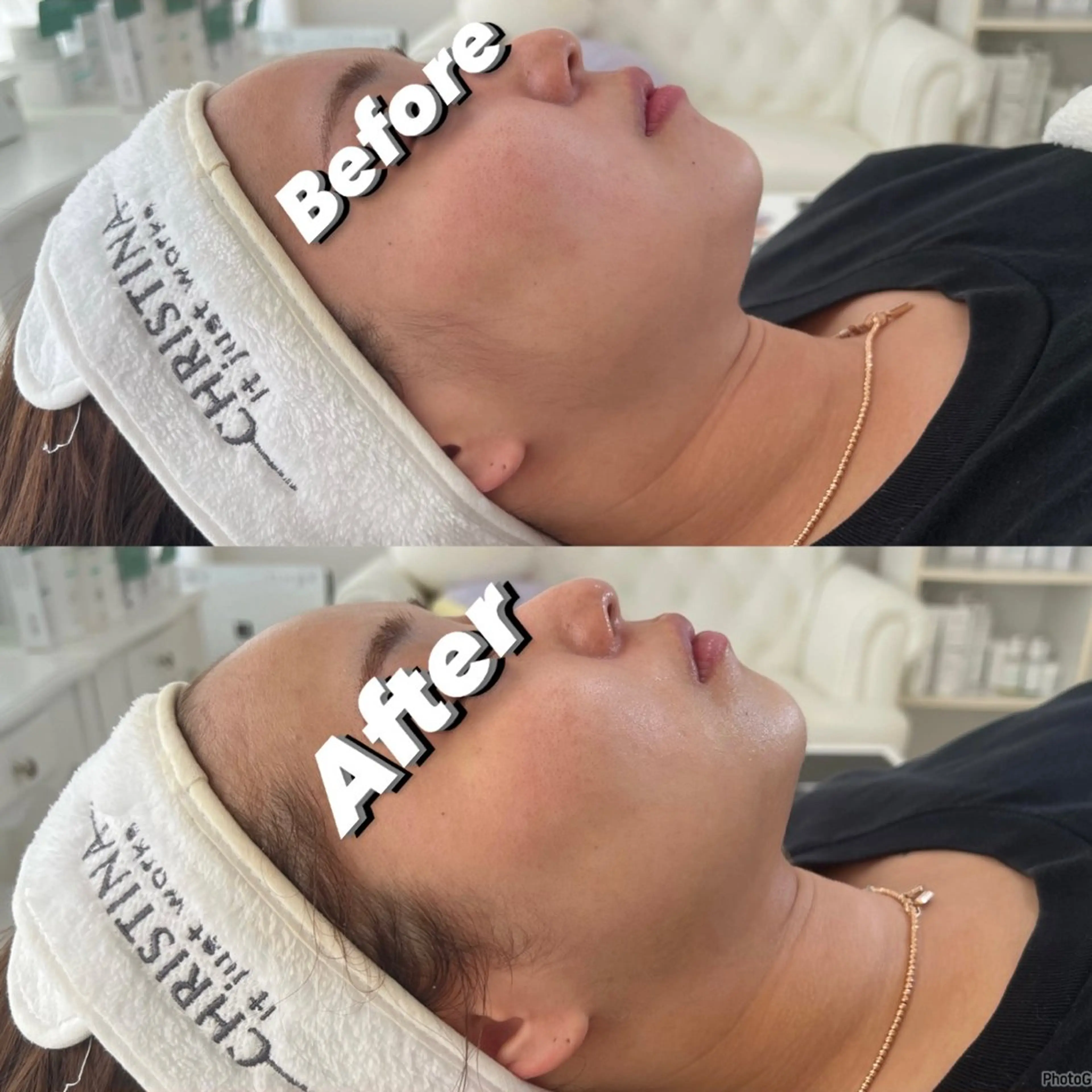 エステ 脱毛＆Beauty salon IILA所属・HBL💖 Sakuraの眉毛・アイブロウイメージ