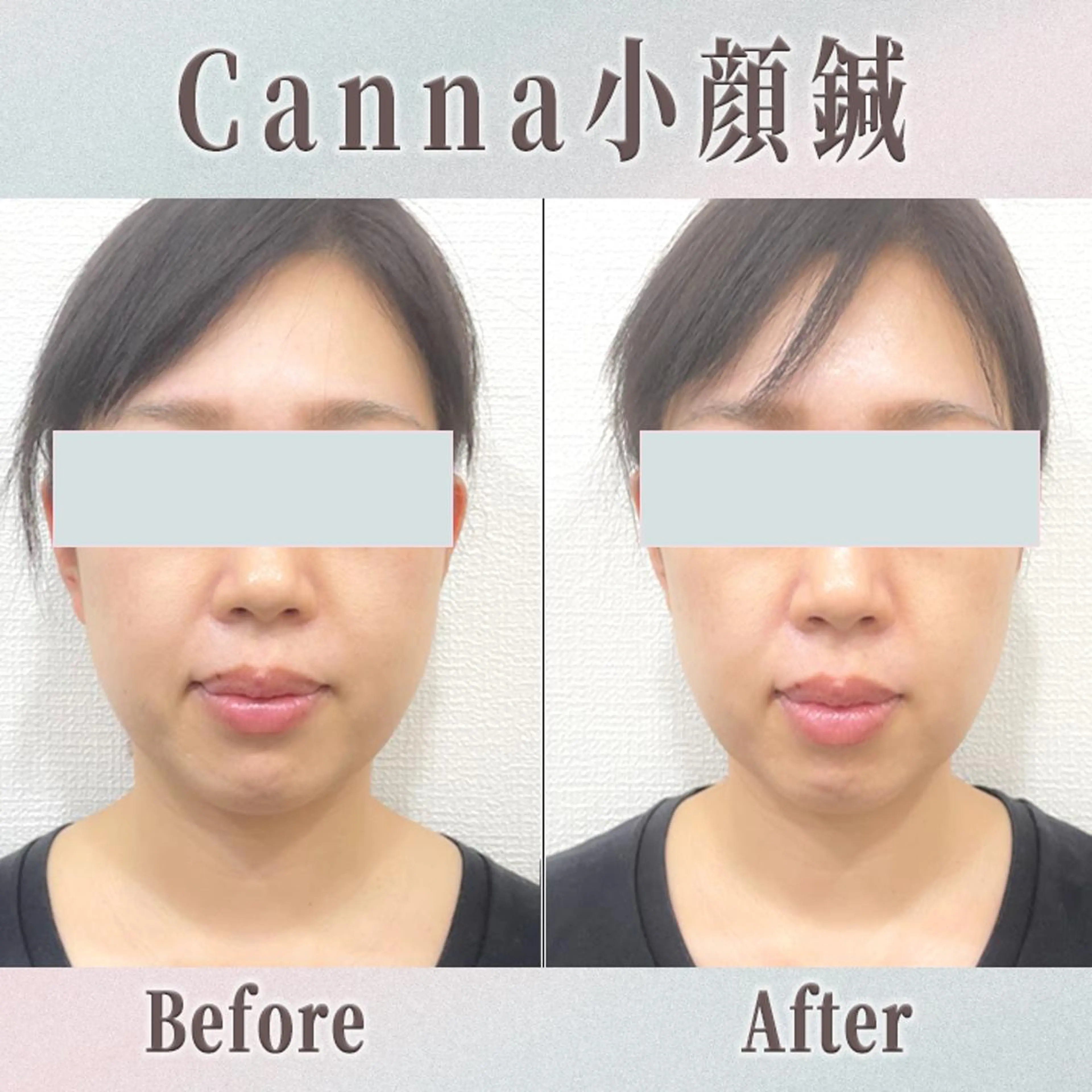 エステ リラク 【美容鍼・小顔鍼】 鍼灸師　森原拓磨のエステ・リラクイメージ