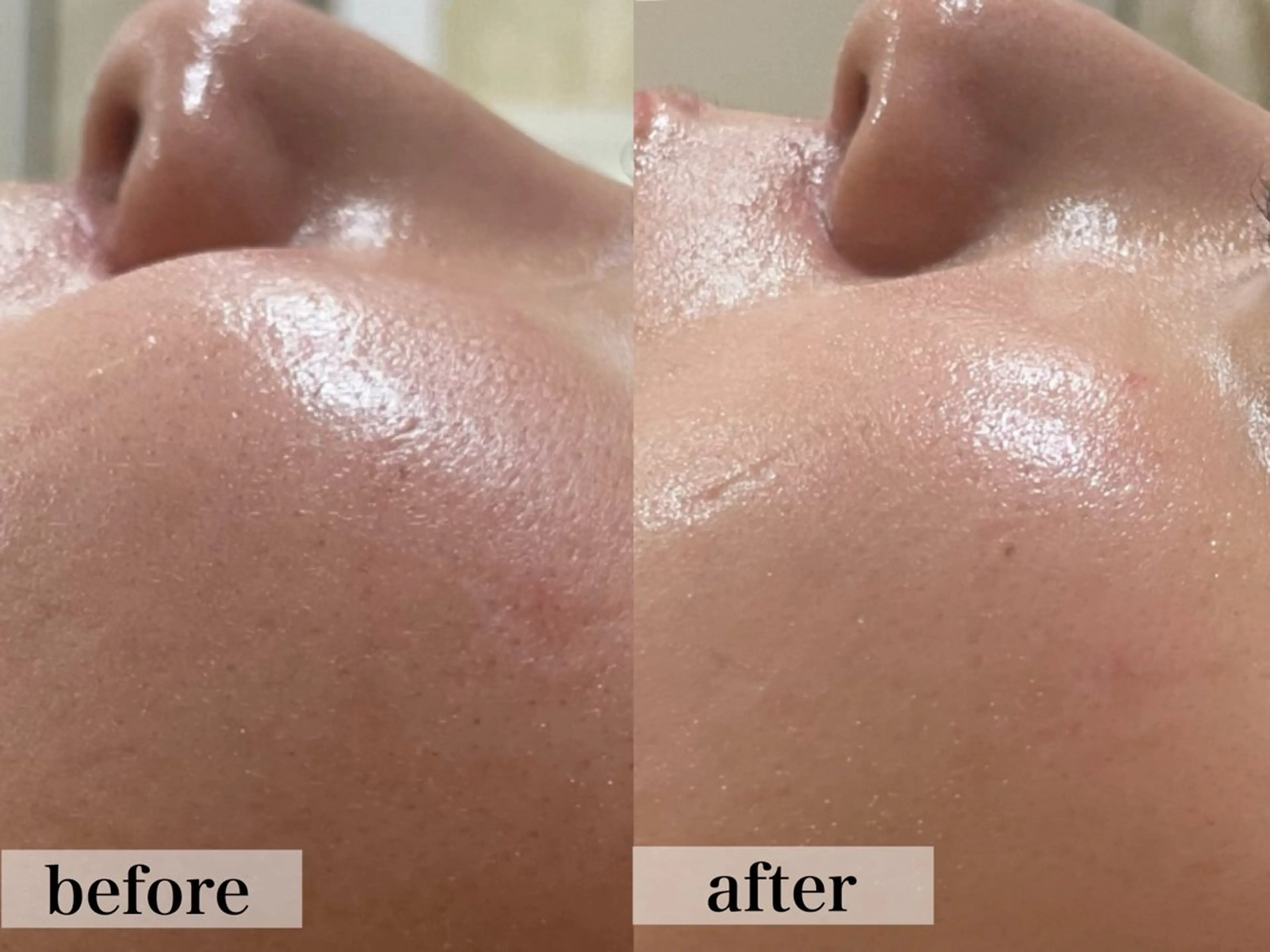 エステ矢野 ジョアアンジェ心斎橋のエステ・リラクイメージ