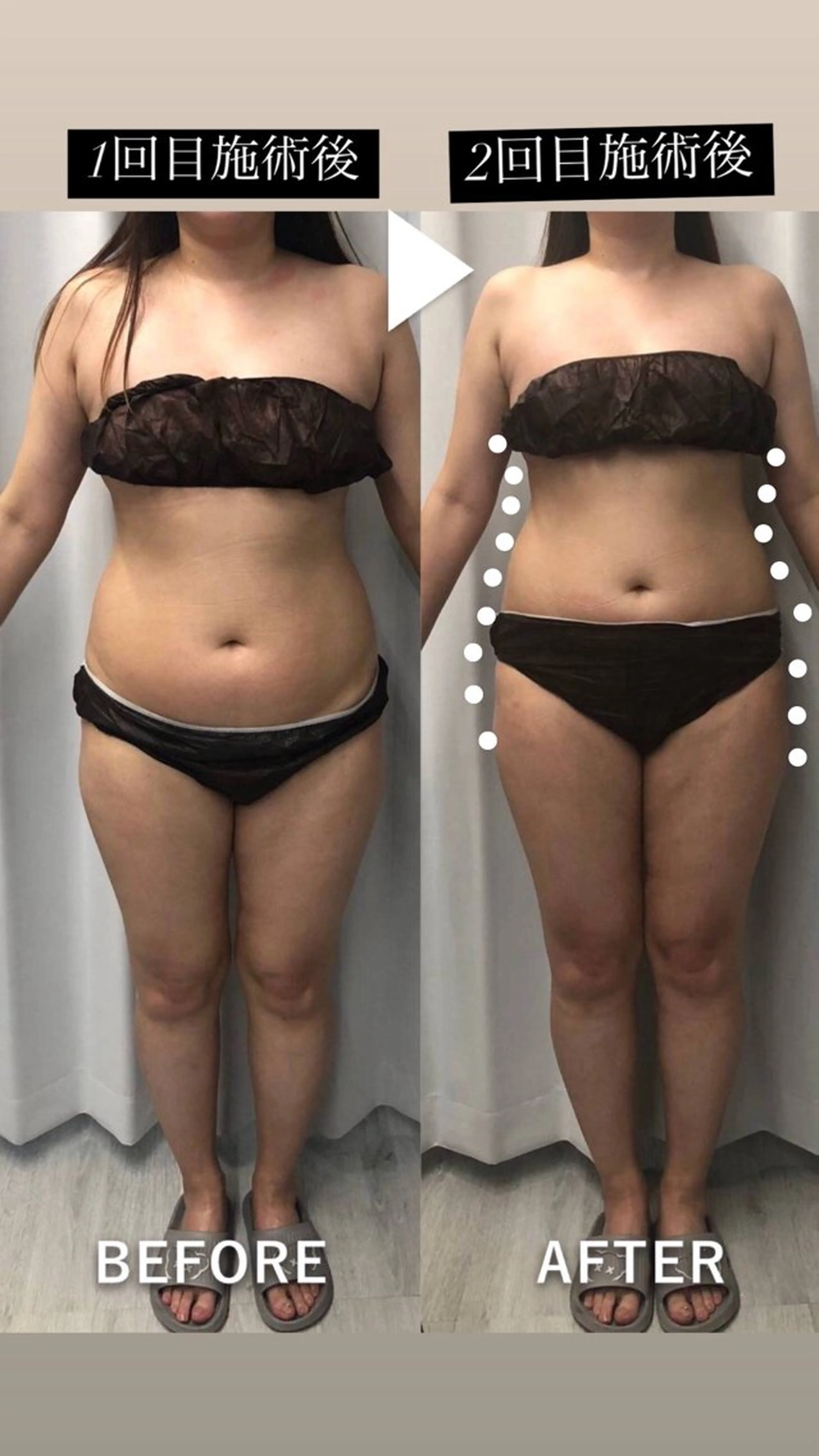 痩身・脱毛・肌管理 Rechica心斎橋のエステ・リラクイメージ