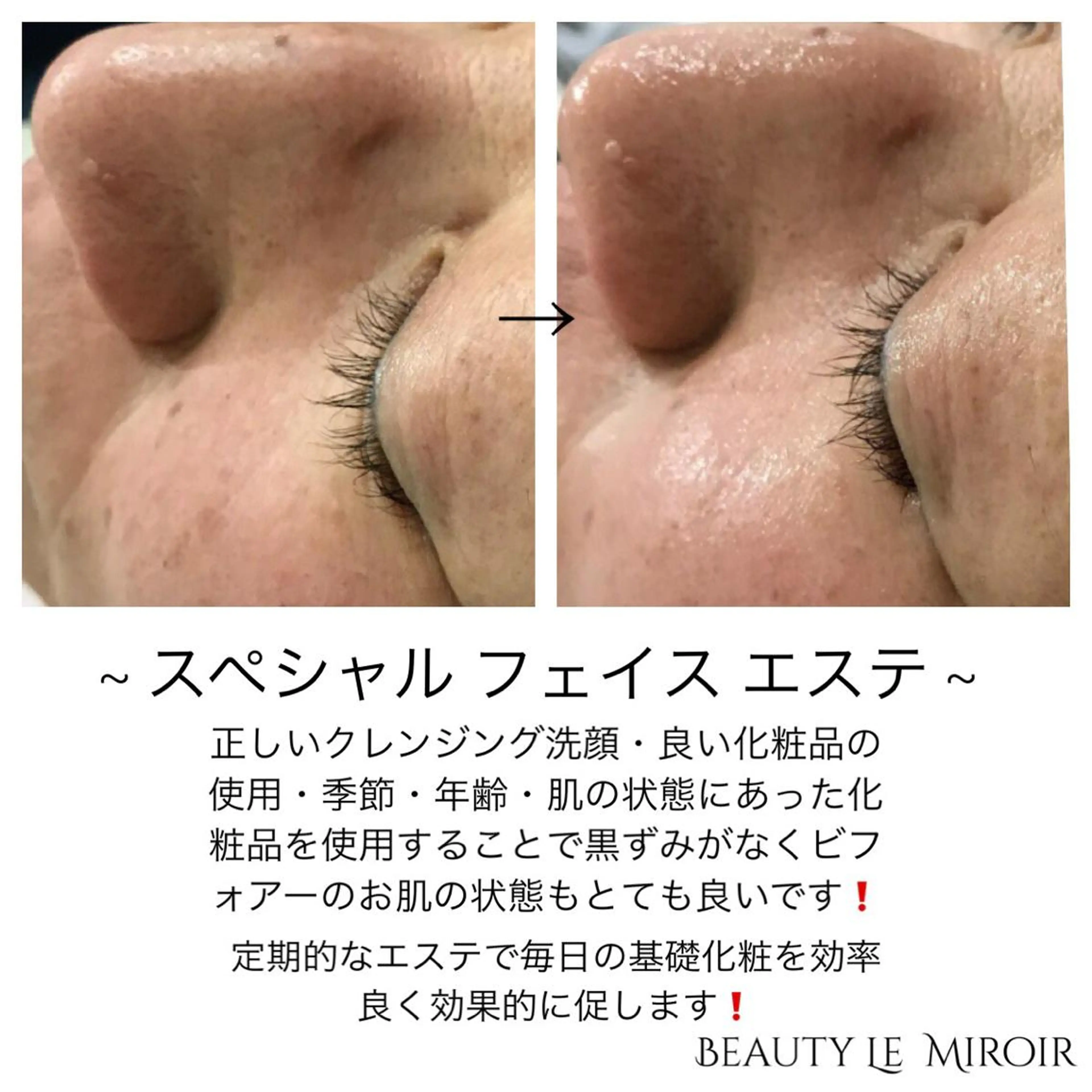 ビューティー ミロワールのエステ・リラクイメージ