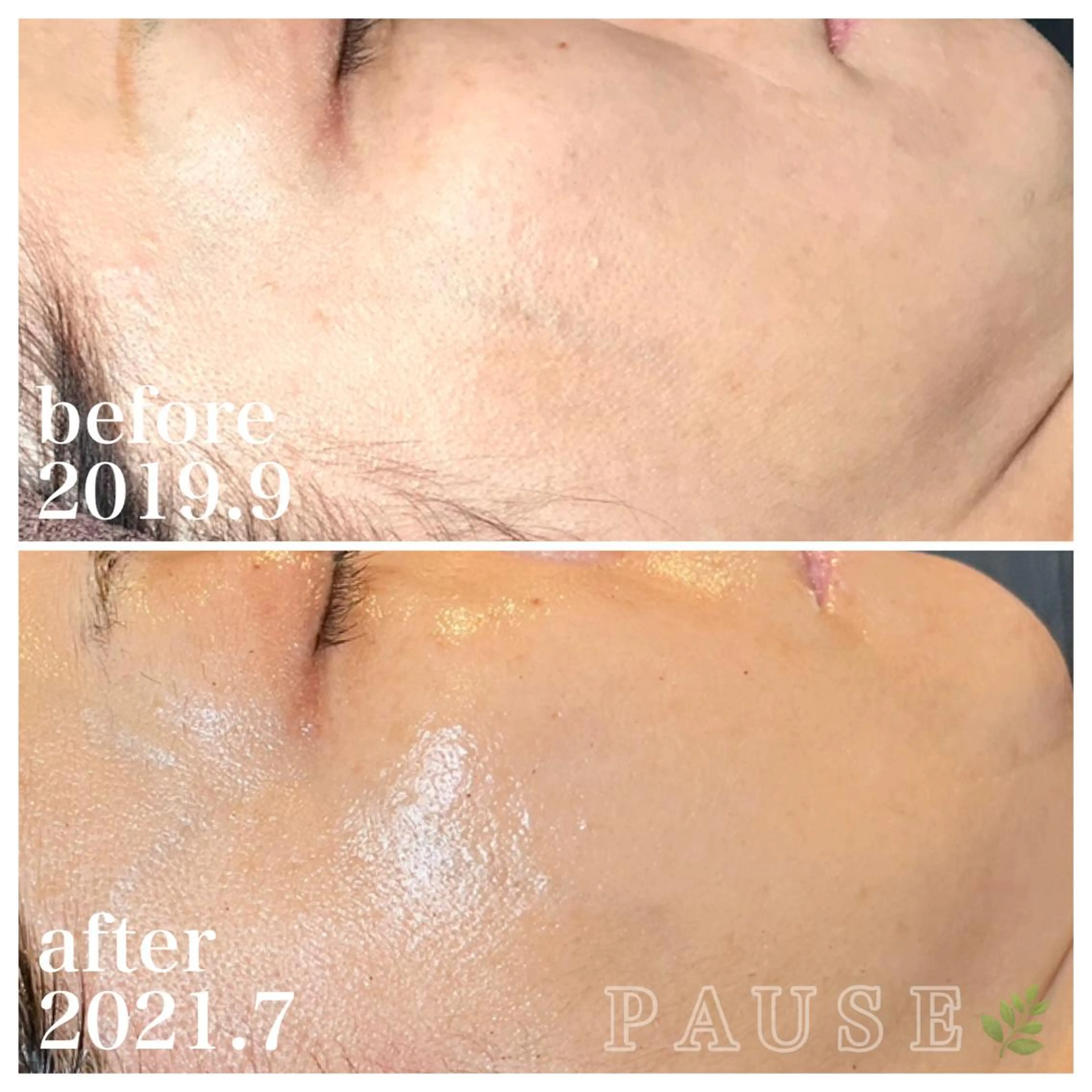 エステ 浜野 恵美のエステ・リラクイメージ