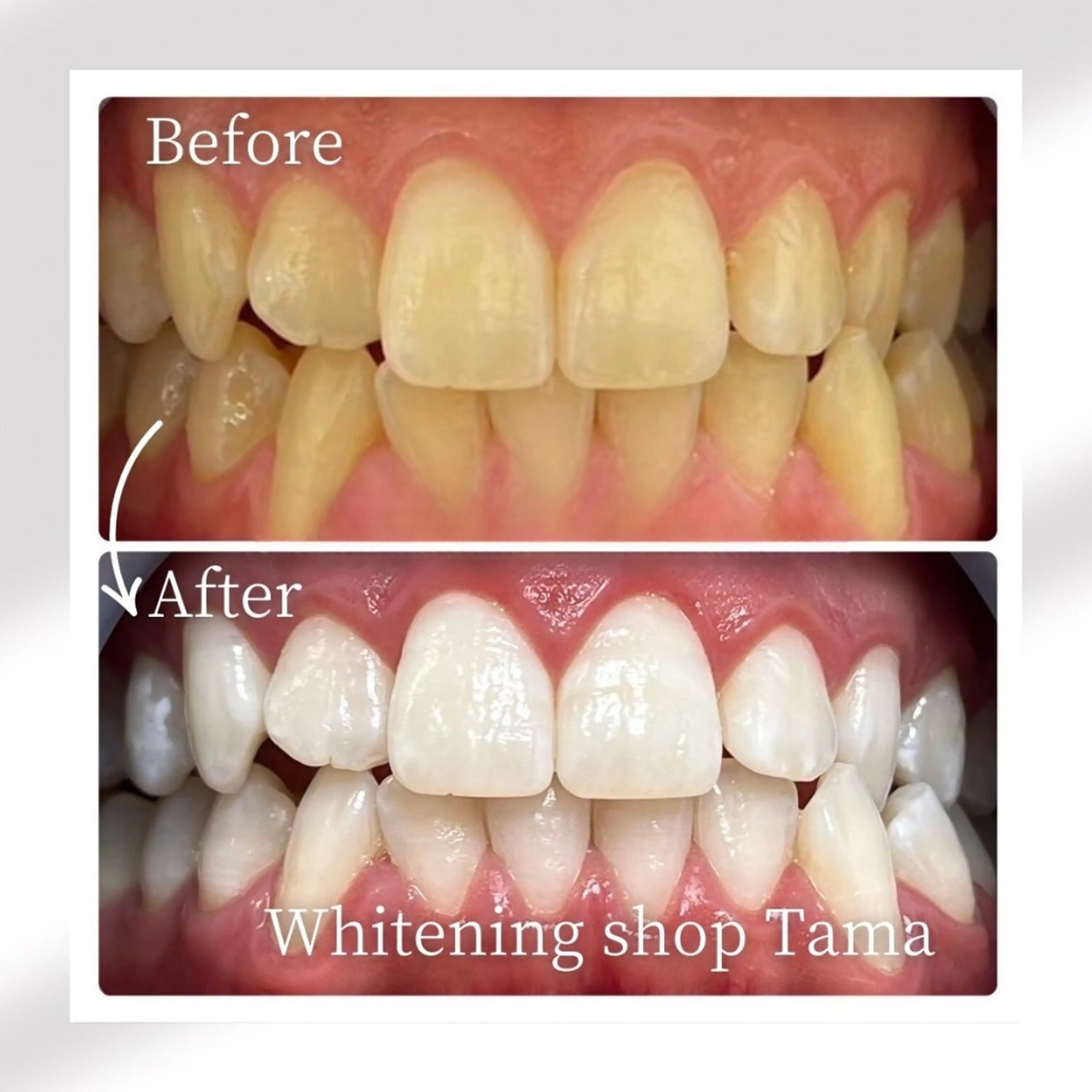 メンズ その他 ホワイトニング ショップ多摩店のその他イメージ