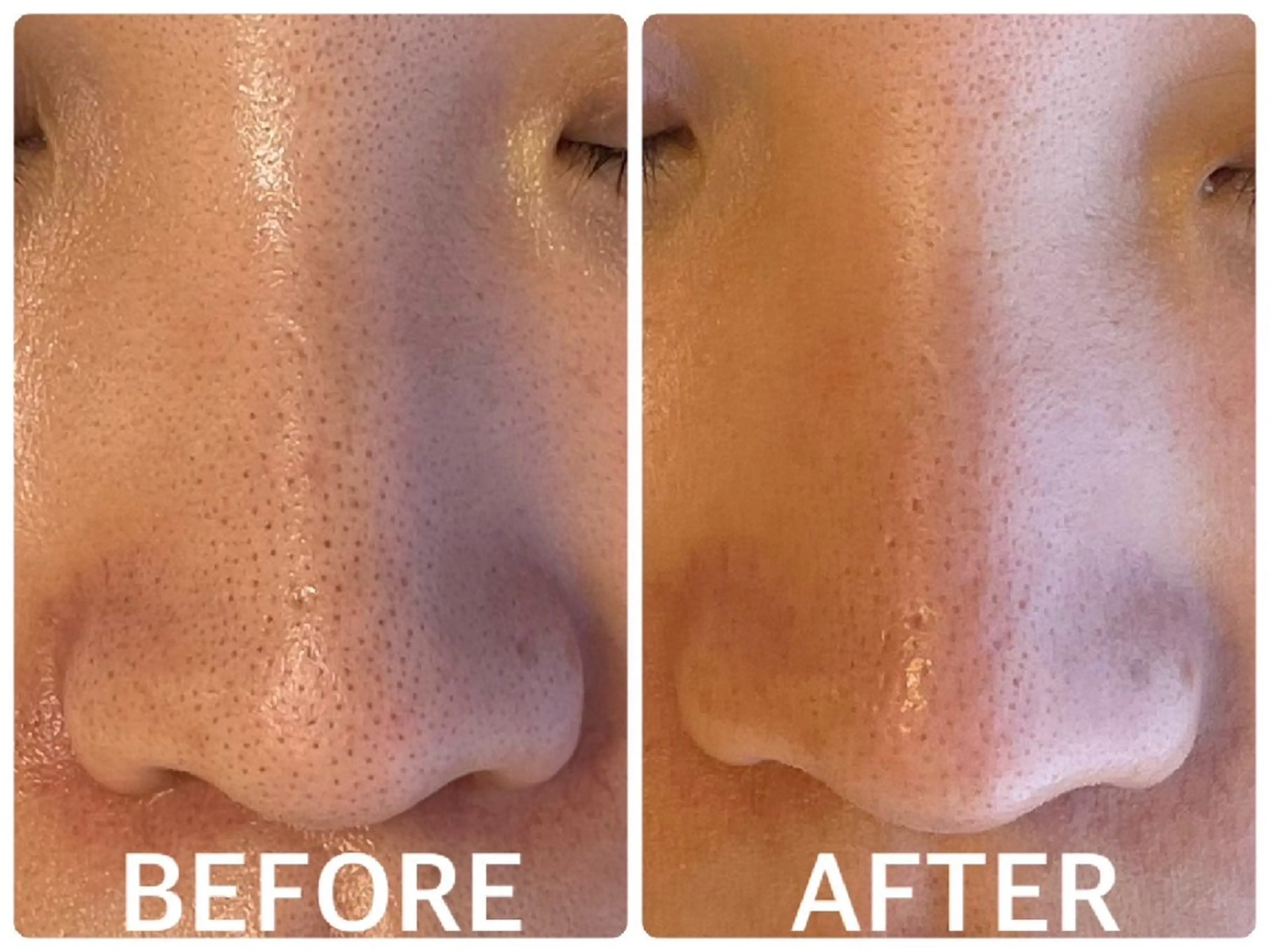 ハーブピーリング横浜 肌質改善専門店のその他イメージ