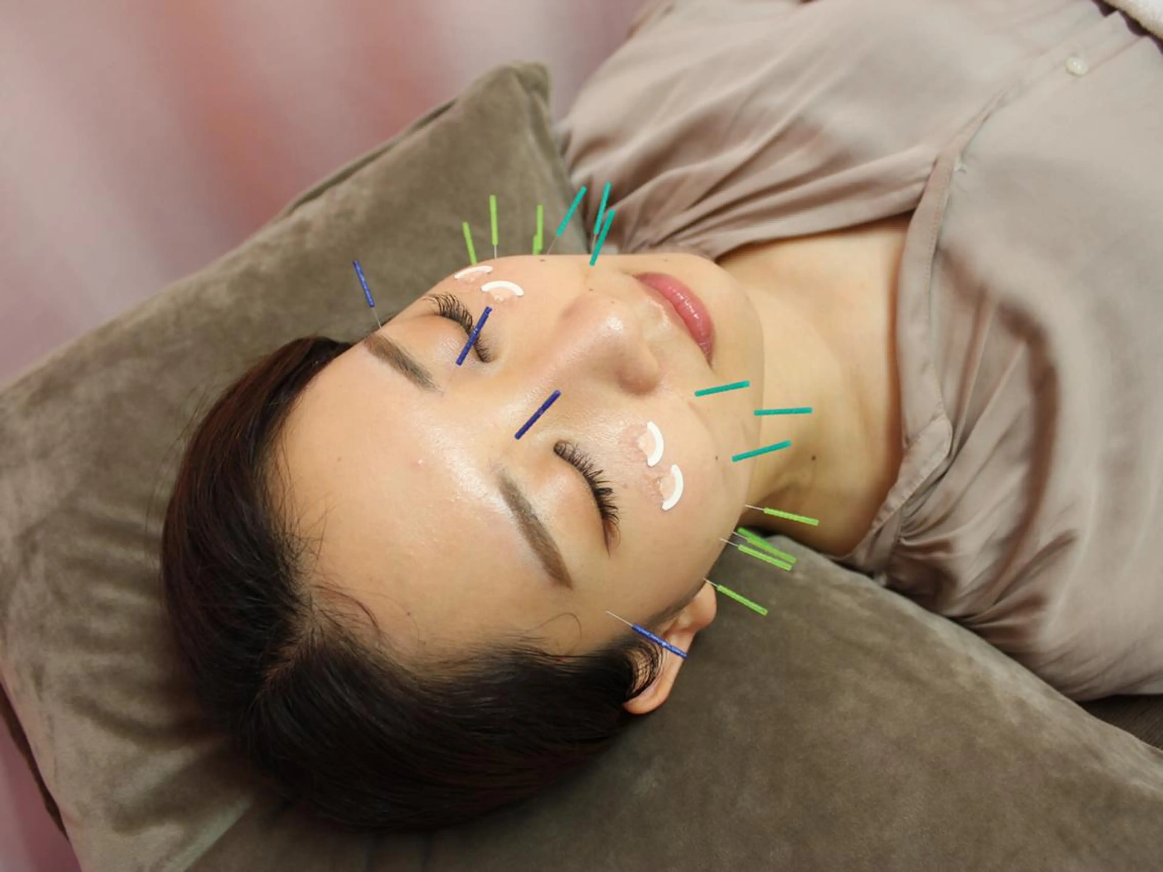 エステ リラク 同心整骨院 美容鍼・整体・小顔のエステ・リラクイメージ