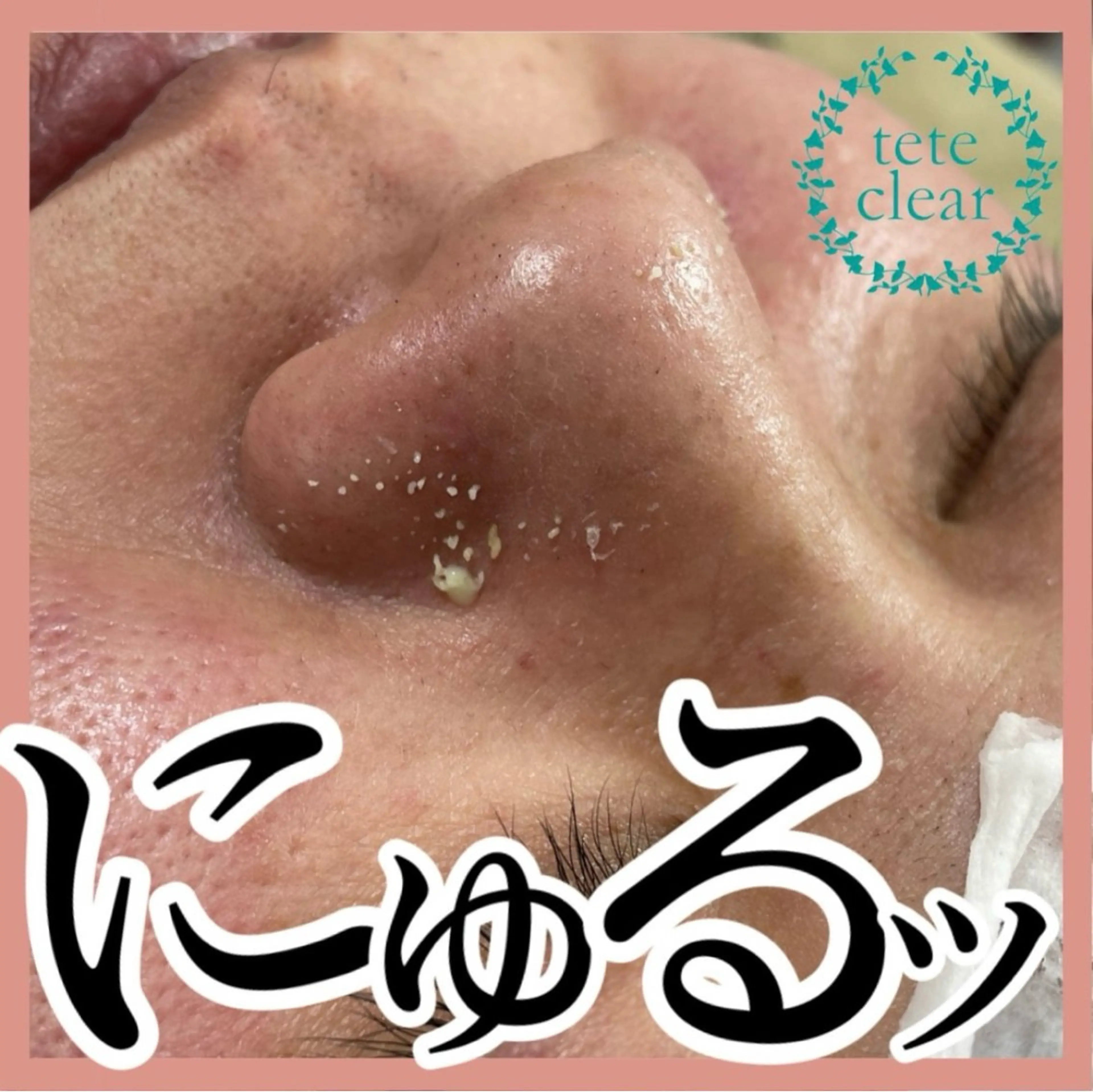 マツエク・マツパ HIKARI a.k.a 神童♡のエステ・リラクイメージ