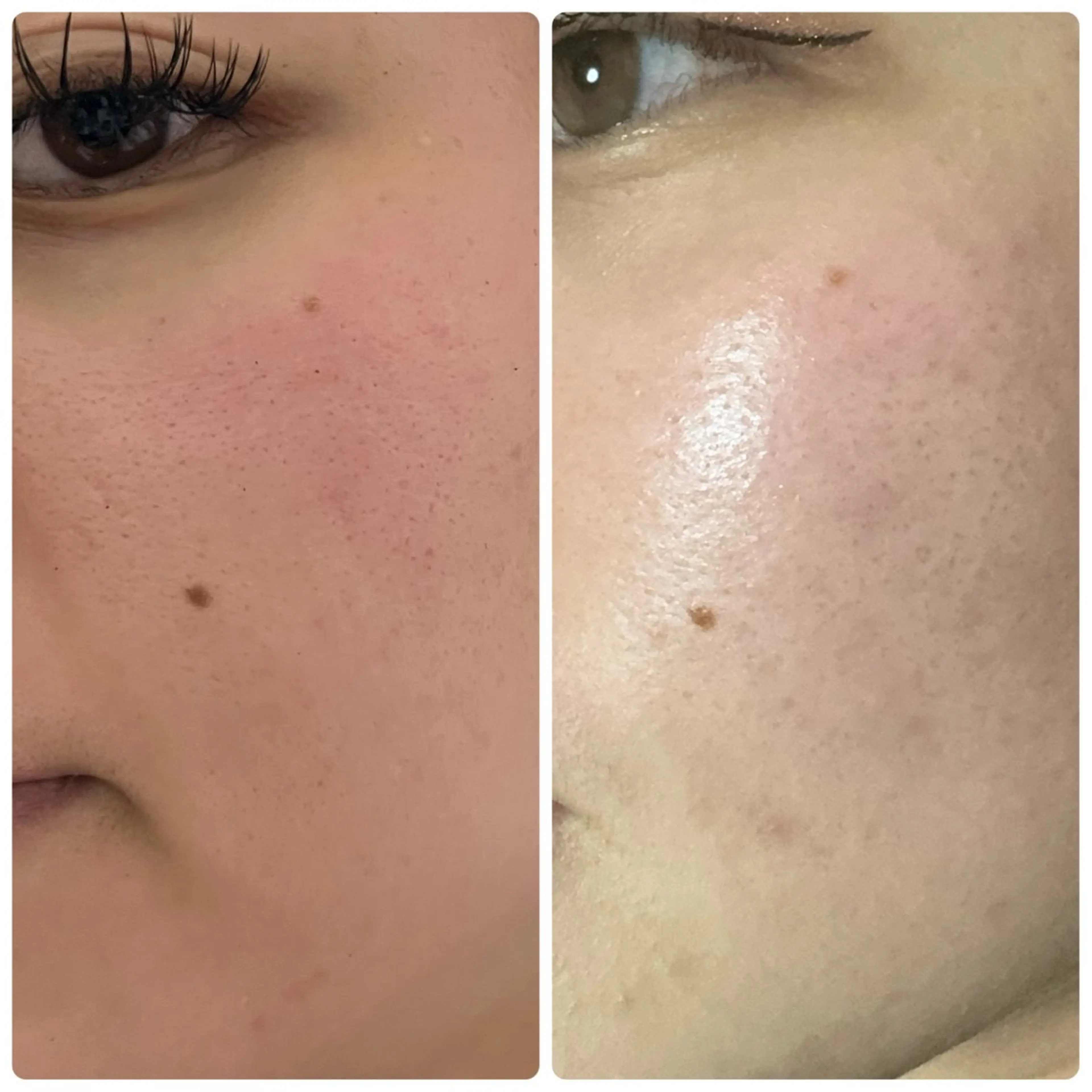 エステ 脱毛&フェイシャル 専門店muro.のエステ・リラクイメージ