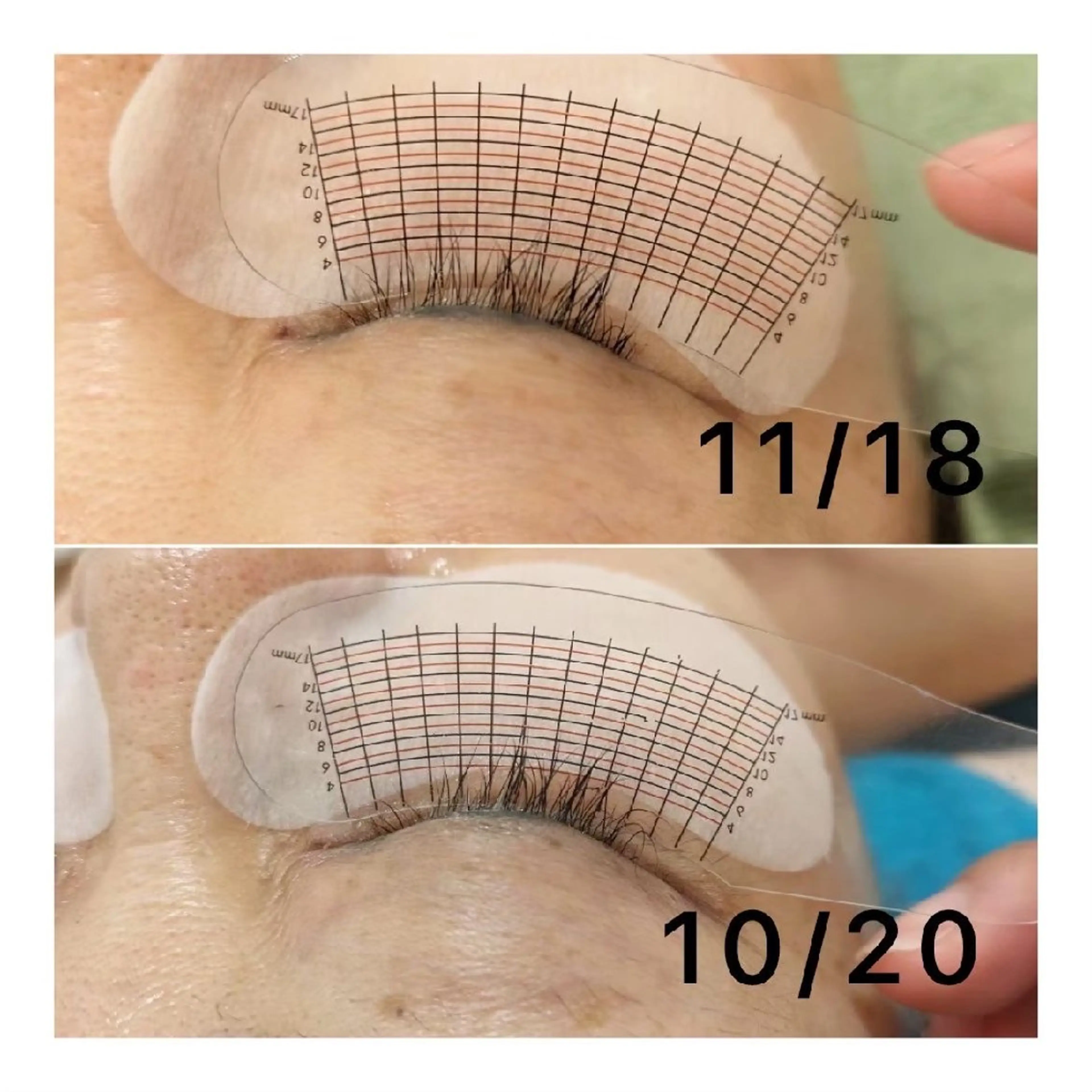 まつ育1回の写真