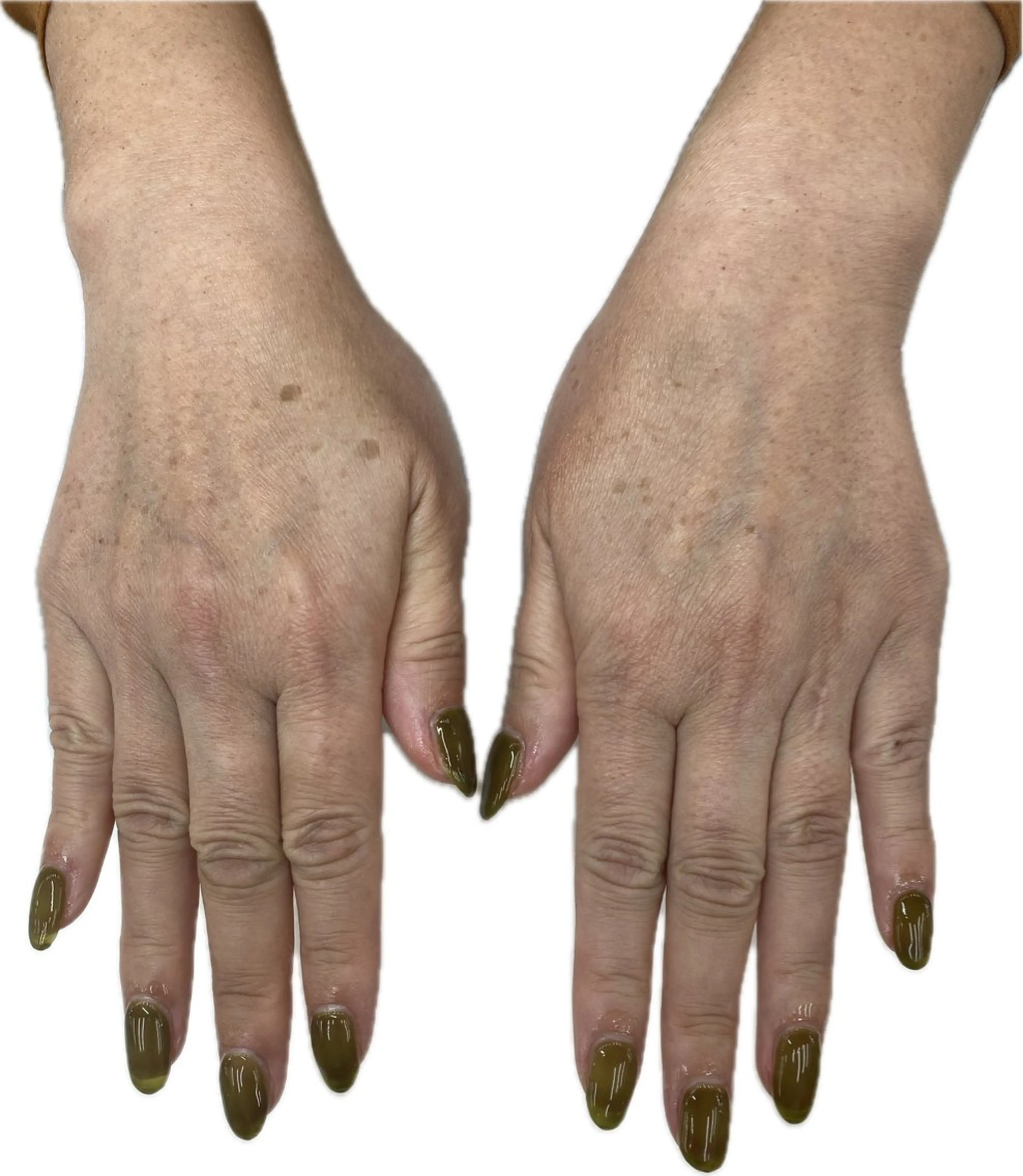 ネイル MAXKELLY AIのネイルデザイン