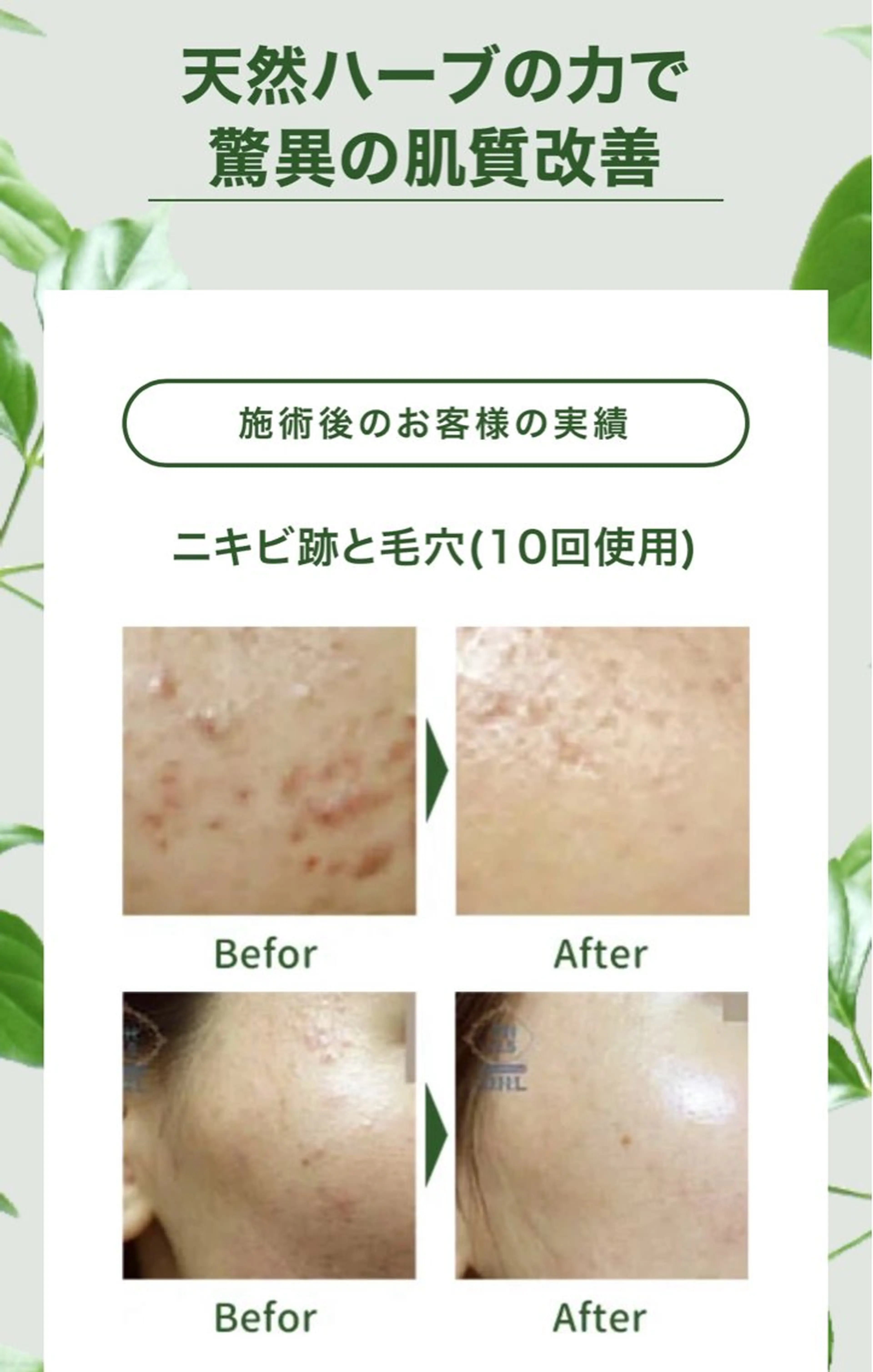 YUIITSU 小顔コルギのエステ・リラクイメージ