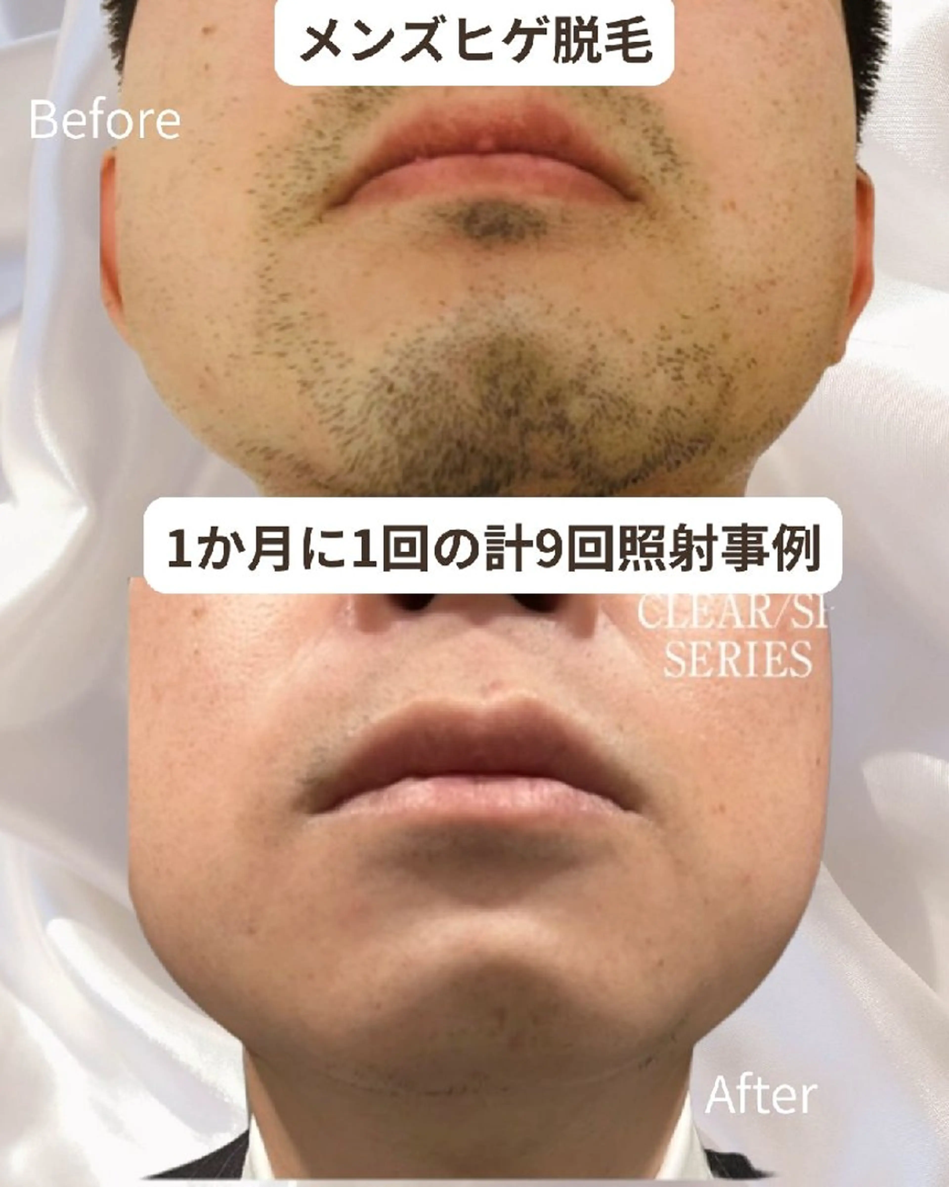 メンズ 脱毛 Maum SkinSalonのエステ・リラクイメージ