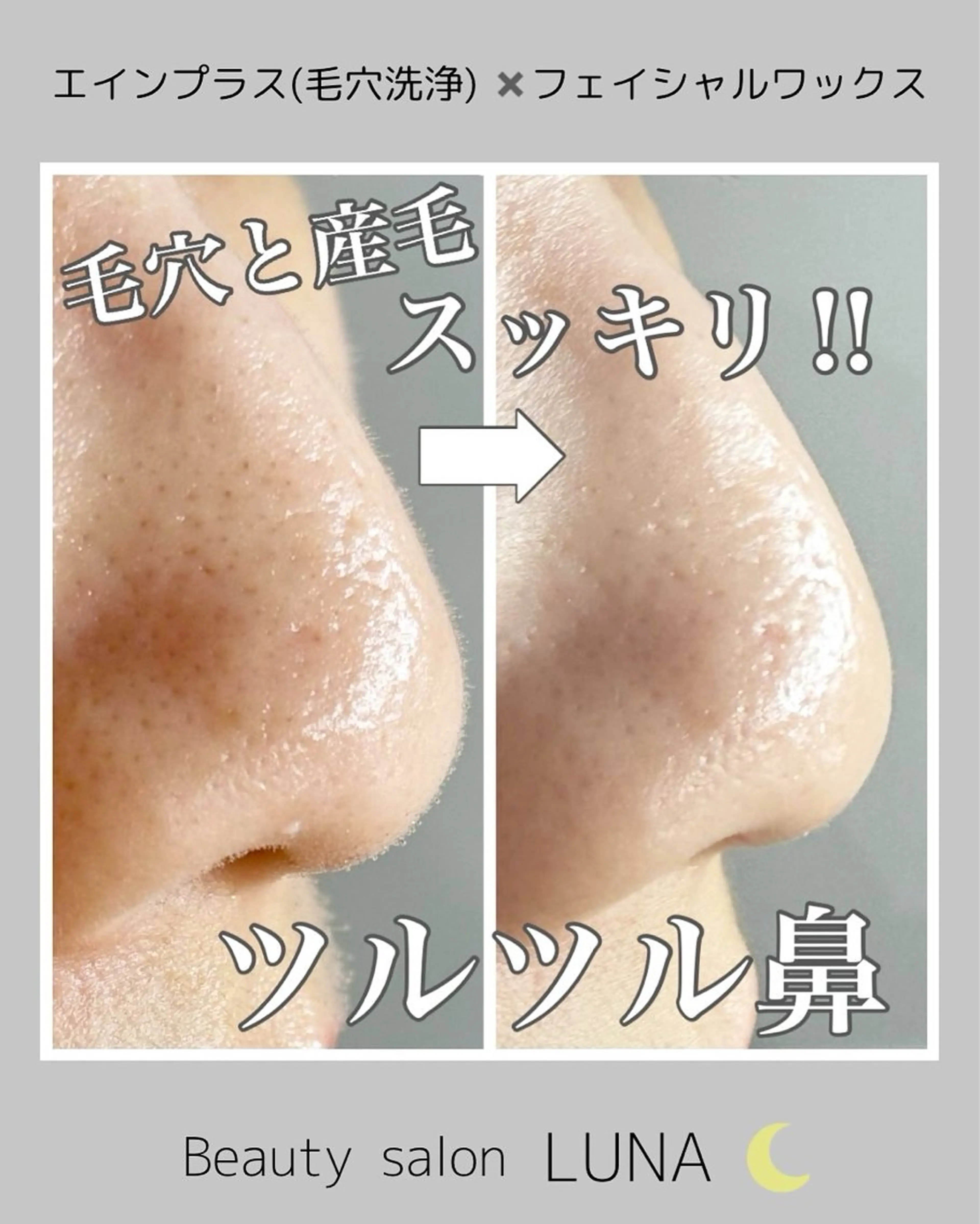 エステ LUNA / Sakikoの眉毛・アイブロウイメージ