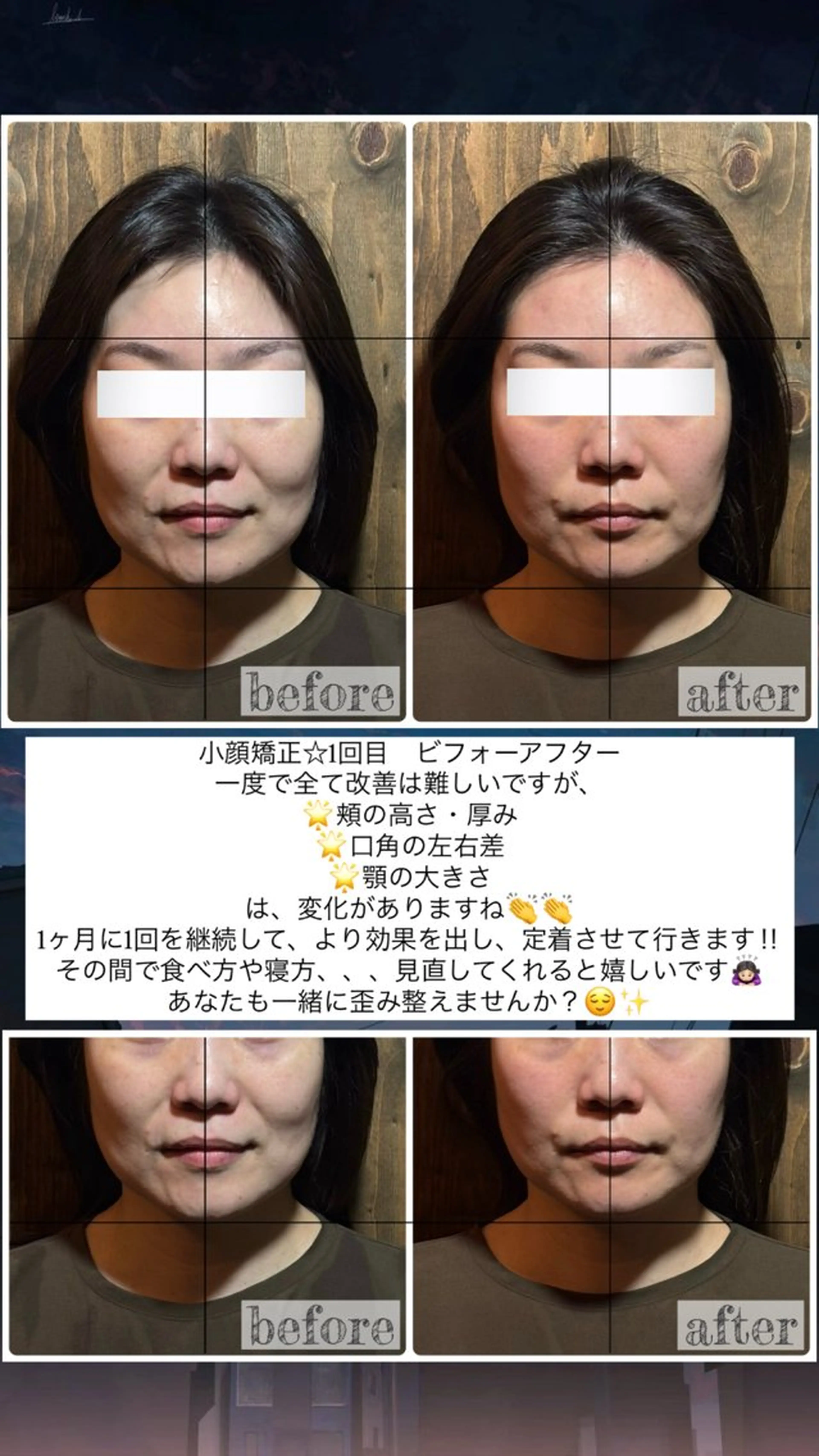 エステ リラク 💎後悔させない小顔 矯正💎イトヤマ🌱のエステ・リラクイメージ