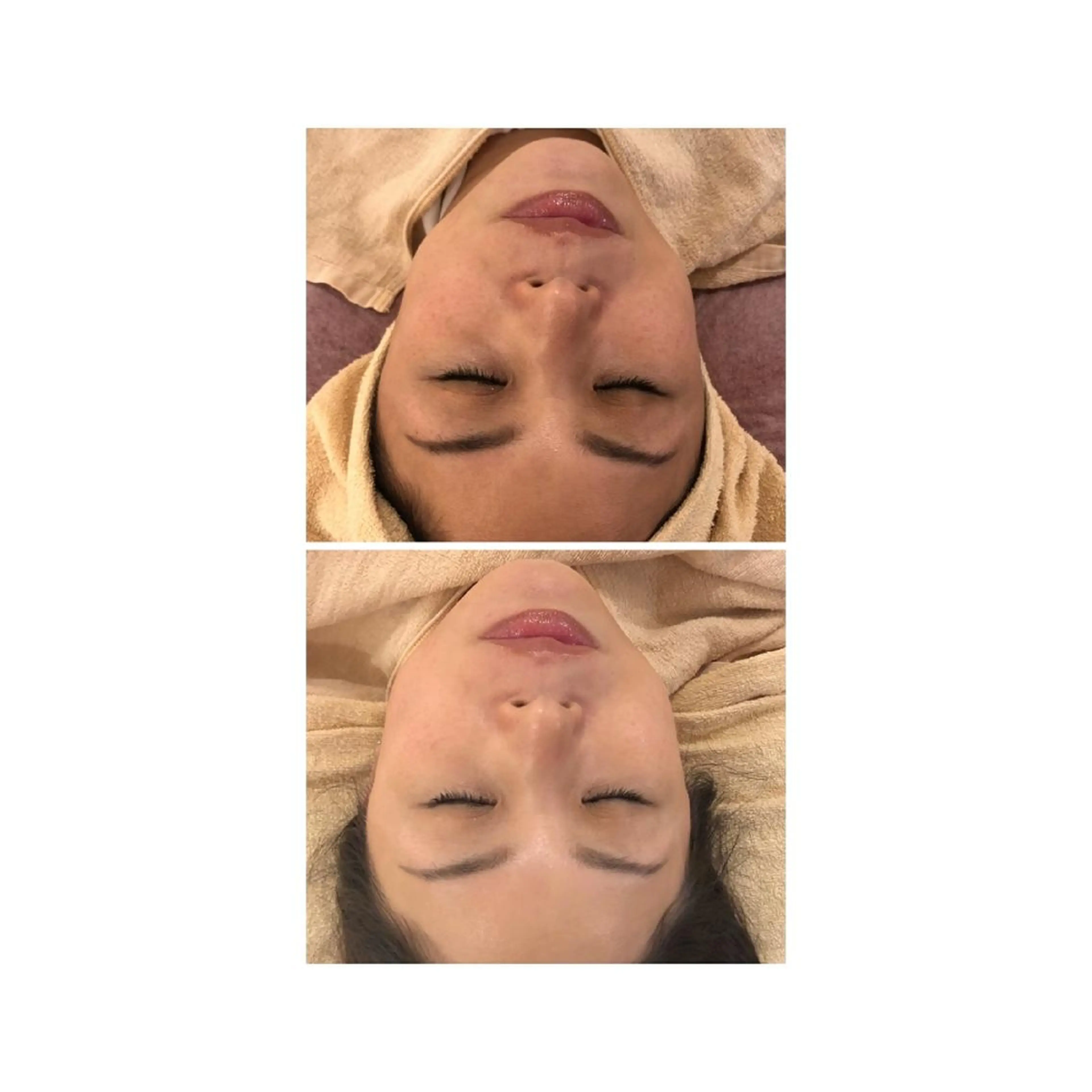 エステ ロゼ ブランシュのエステ・リラクイメージ