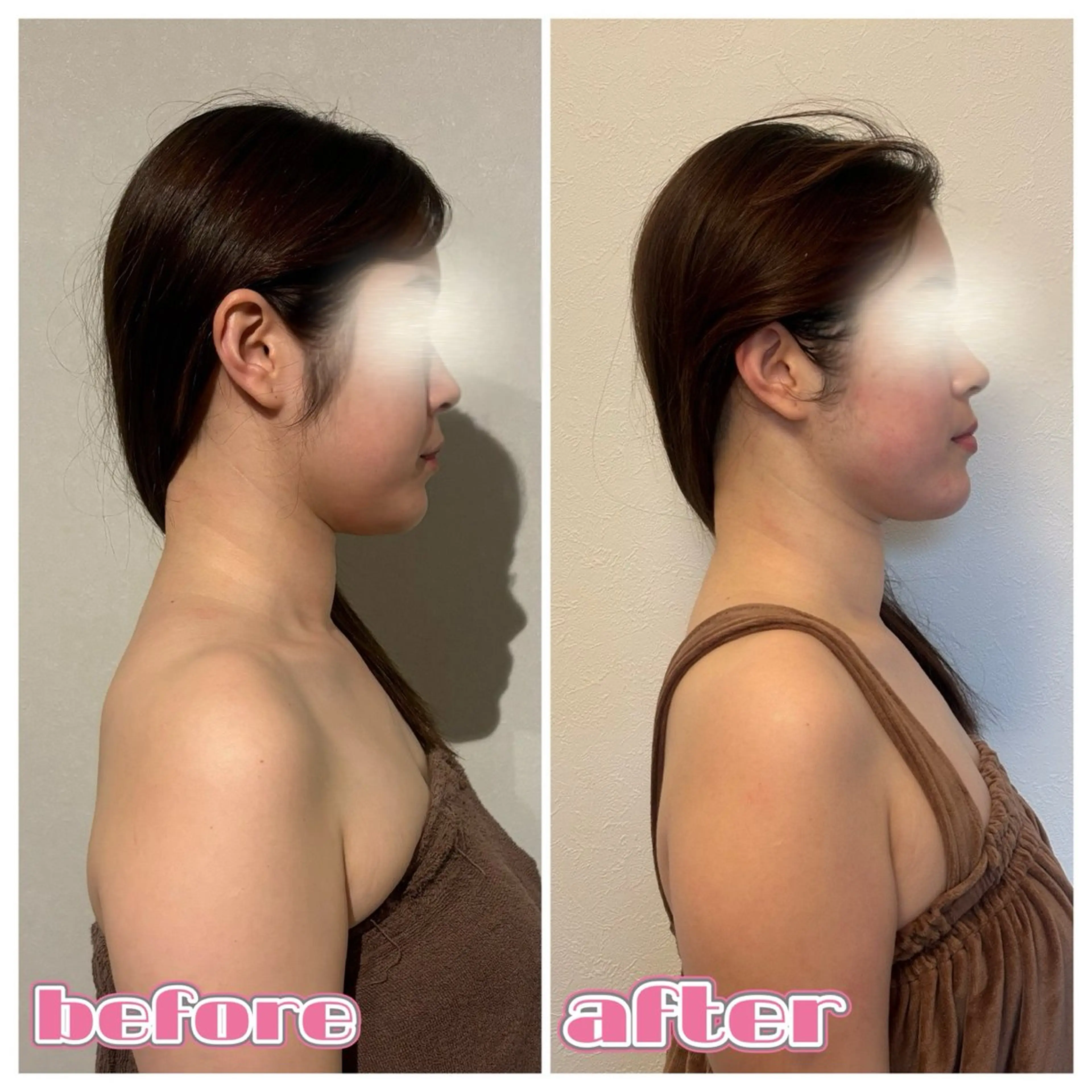 エステ リラク MIRAI小顔 栄店のエステ・リラクイメージ