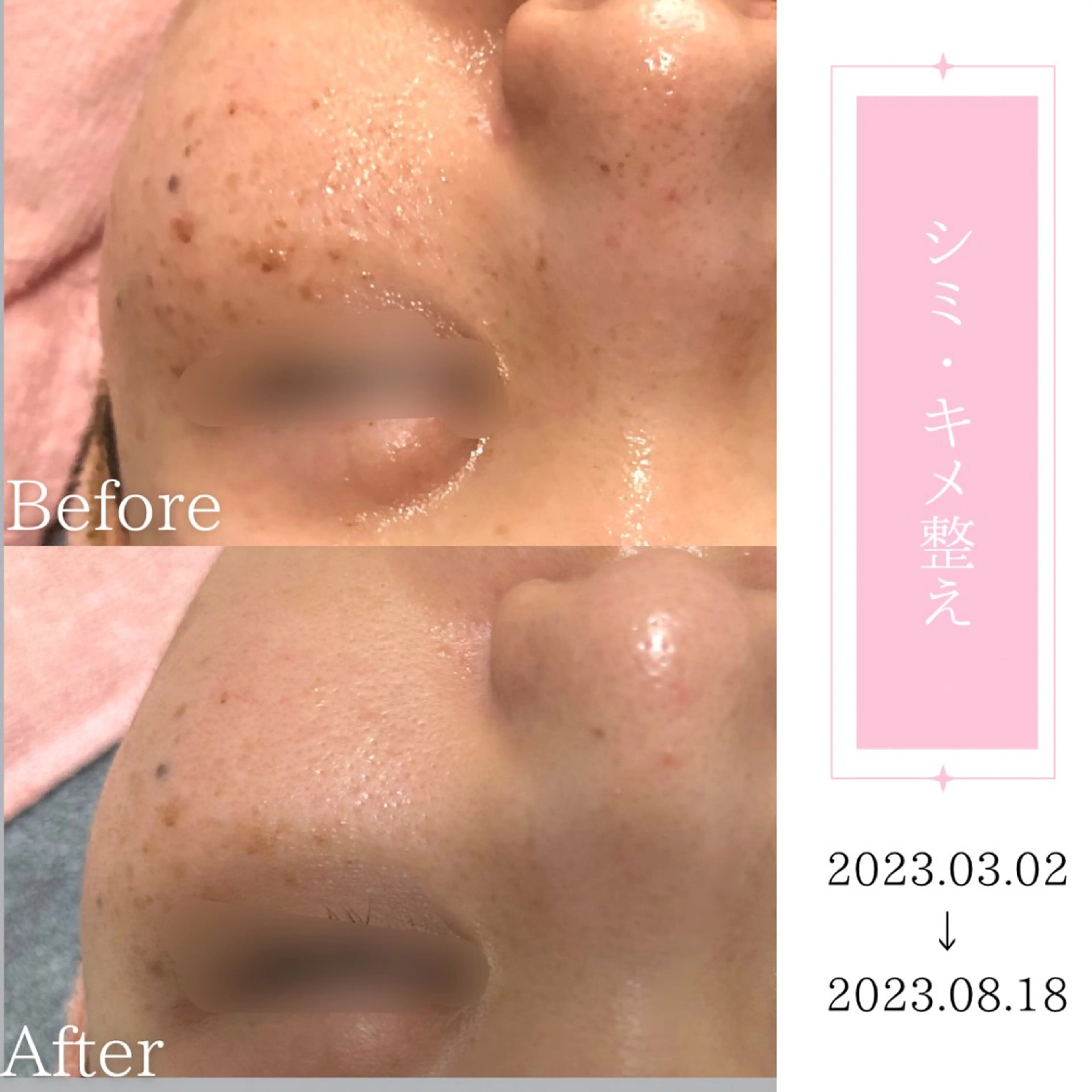 エステ BestBelleꕤ 大阪福島/肌質改善のエステ・リラクイメージ