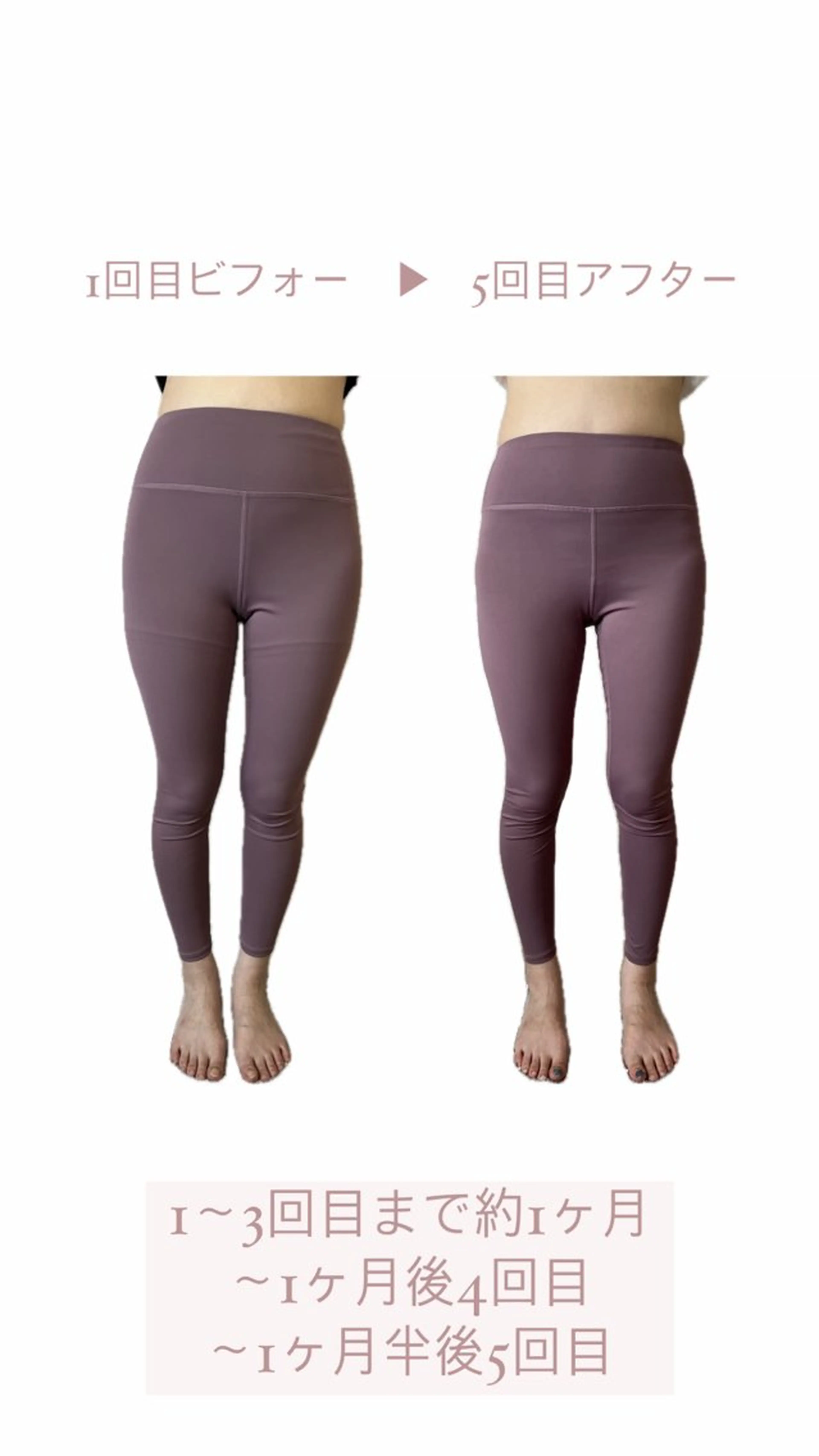 エステ リラク Lilas 【リラ】 小野かづさのエステ・リラクイメージ