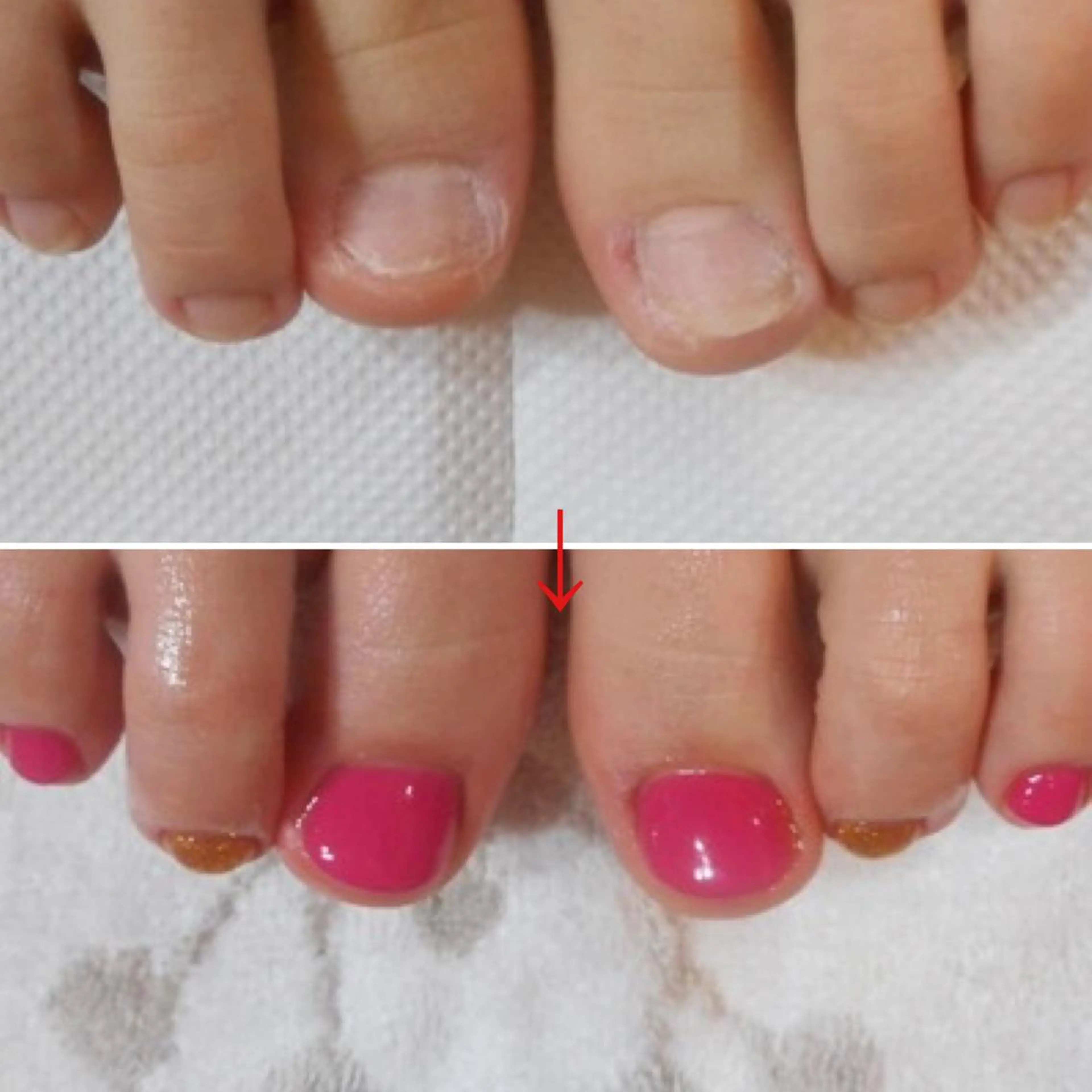 ネイル フットネイル ネイルサロン アリュームのネイルデザイン