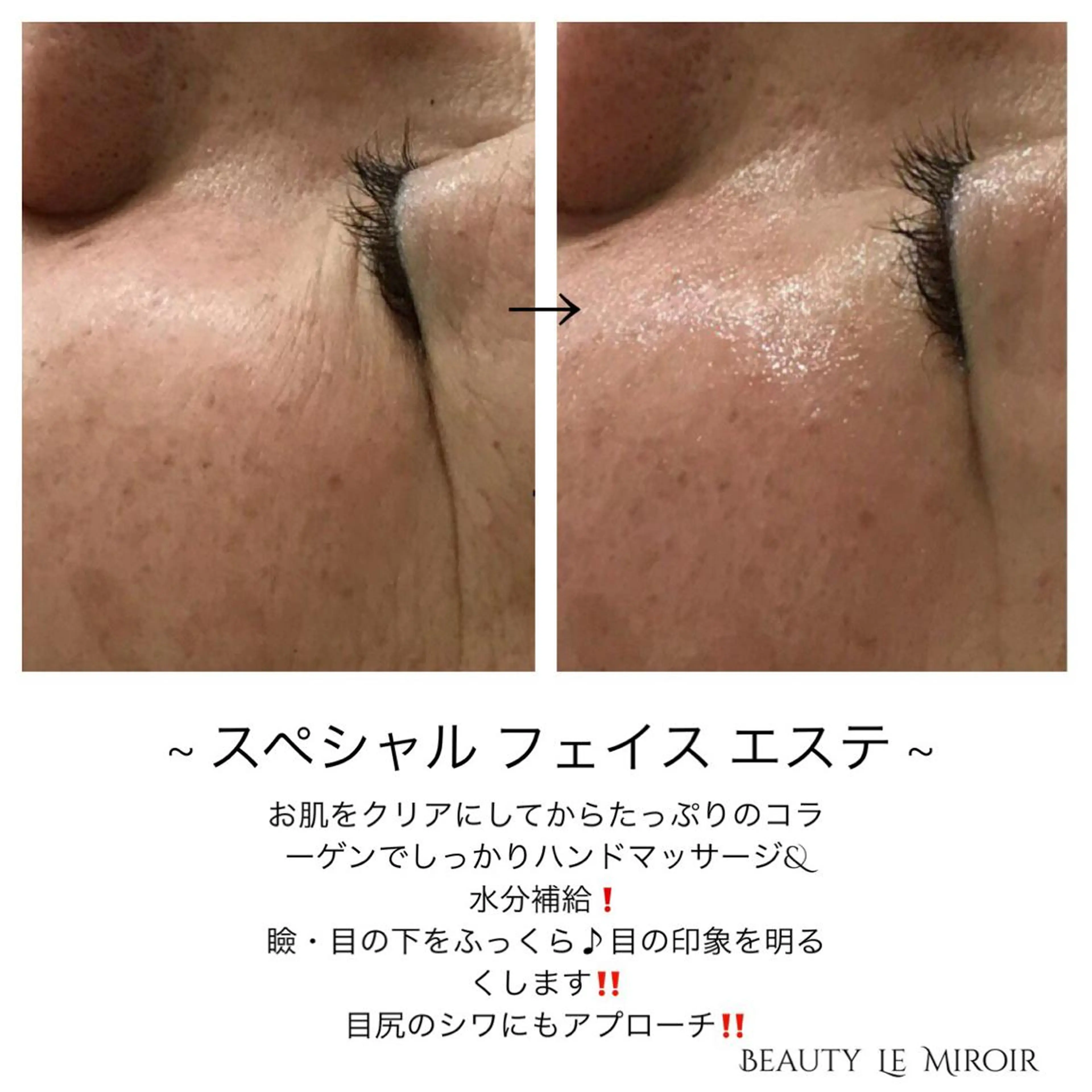 ビューティー ミロワールのエステ・リラクイメージ