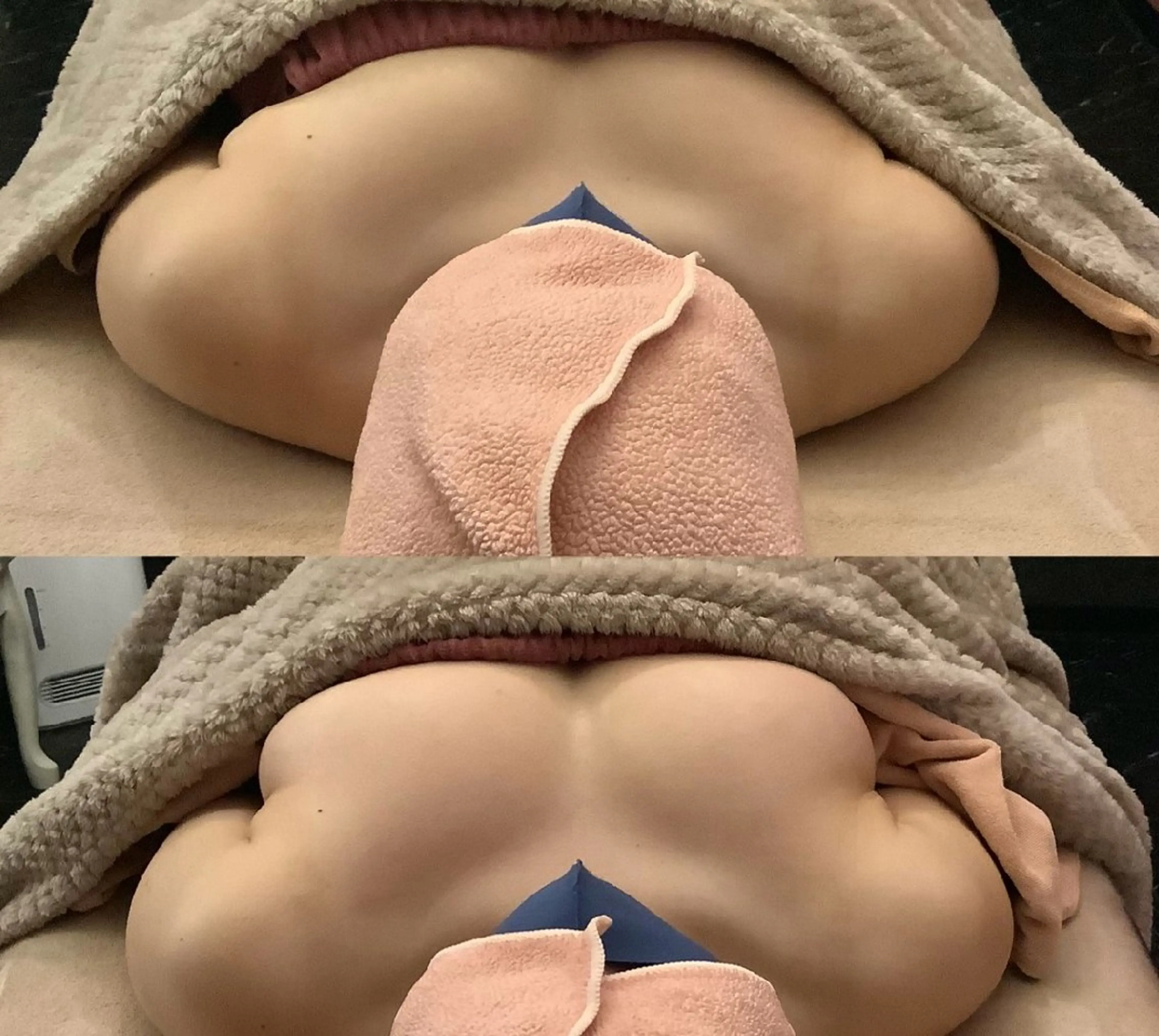 《2カップ​〜​3カップUPを叶える》NRプレミアムバスト＋導入美容液付き体験コースの写真