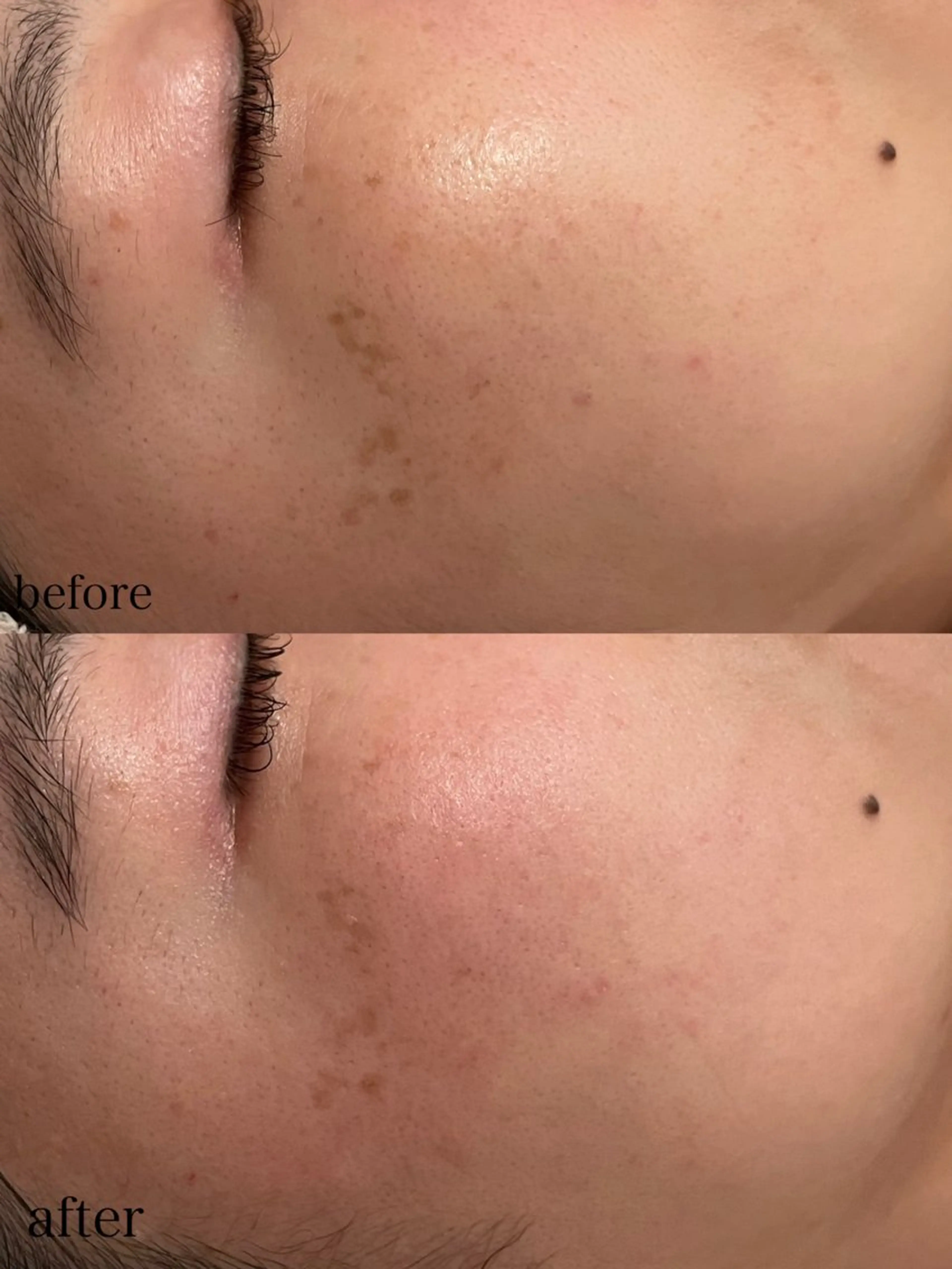 エステ ポテンツァ&針美容 バストアップ専門店のエステ・リラクイメージ