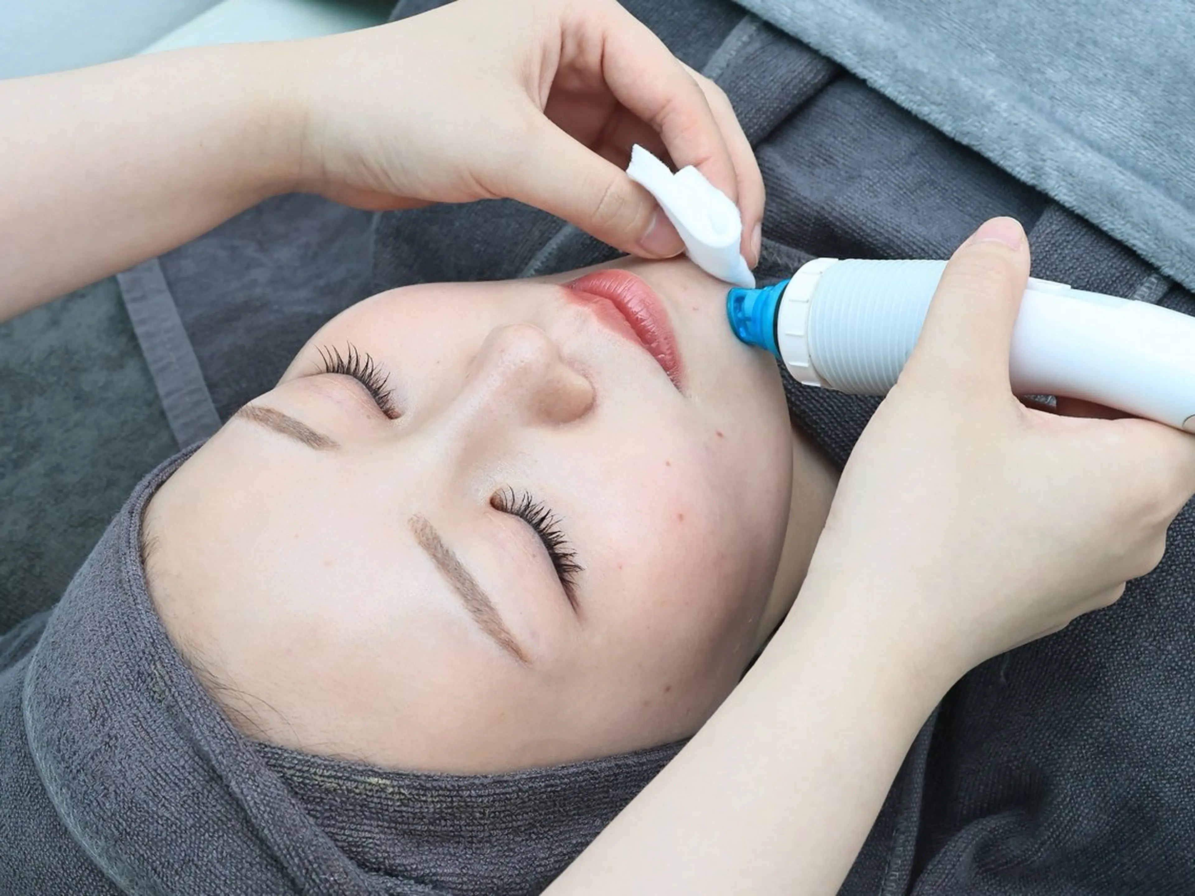 ツヤ肌への第一歩⭐️毛穴洗浄＋鎮静パック【毛穴開き/黒ずみ/ニキビケア】の写真