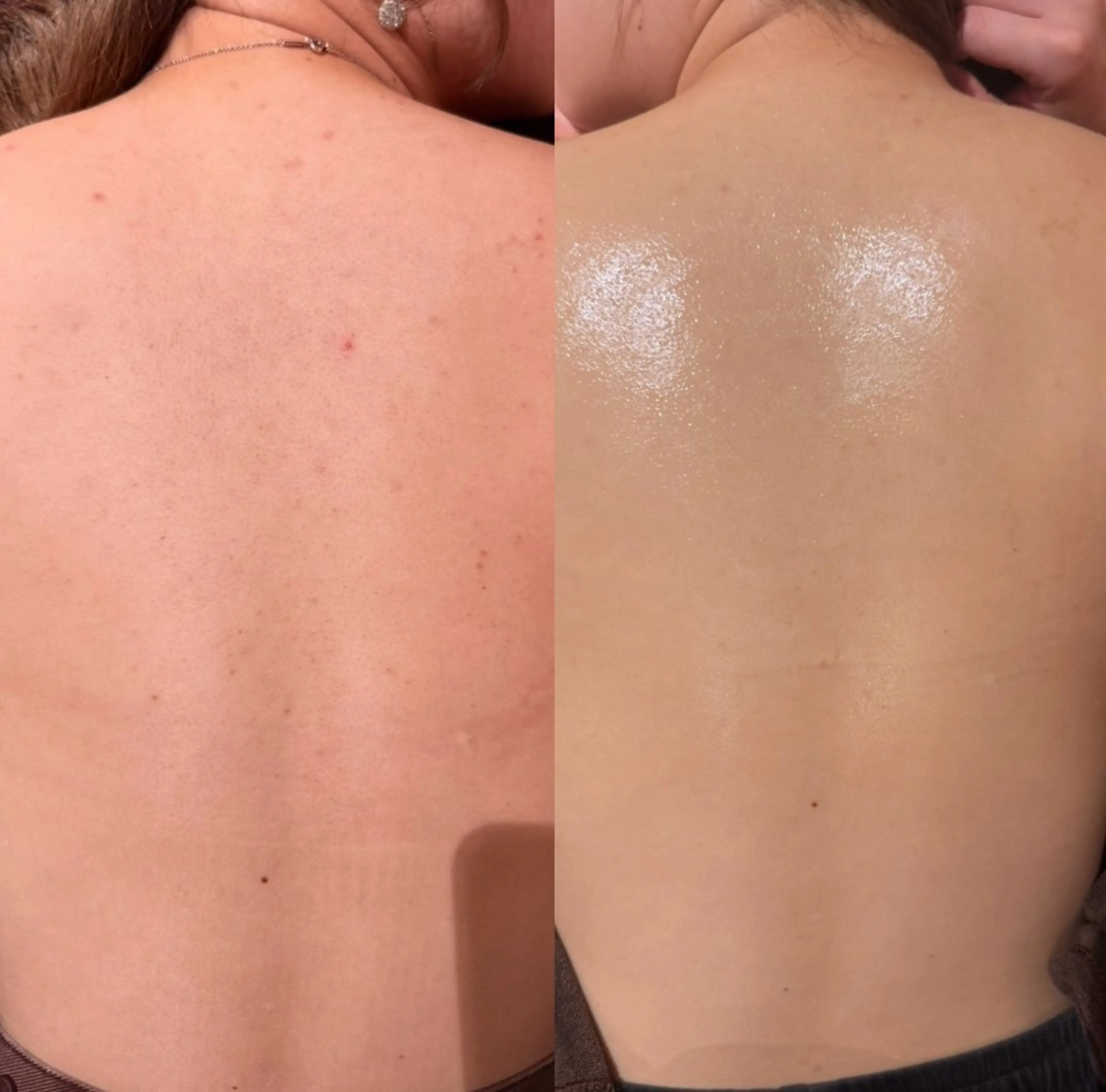 その他 森 美優のエステ・リラクイメージ