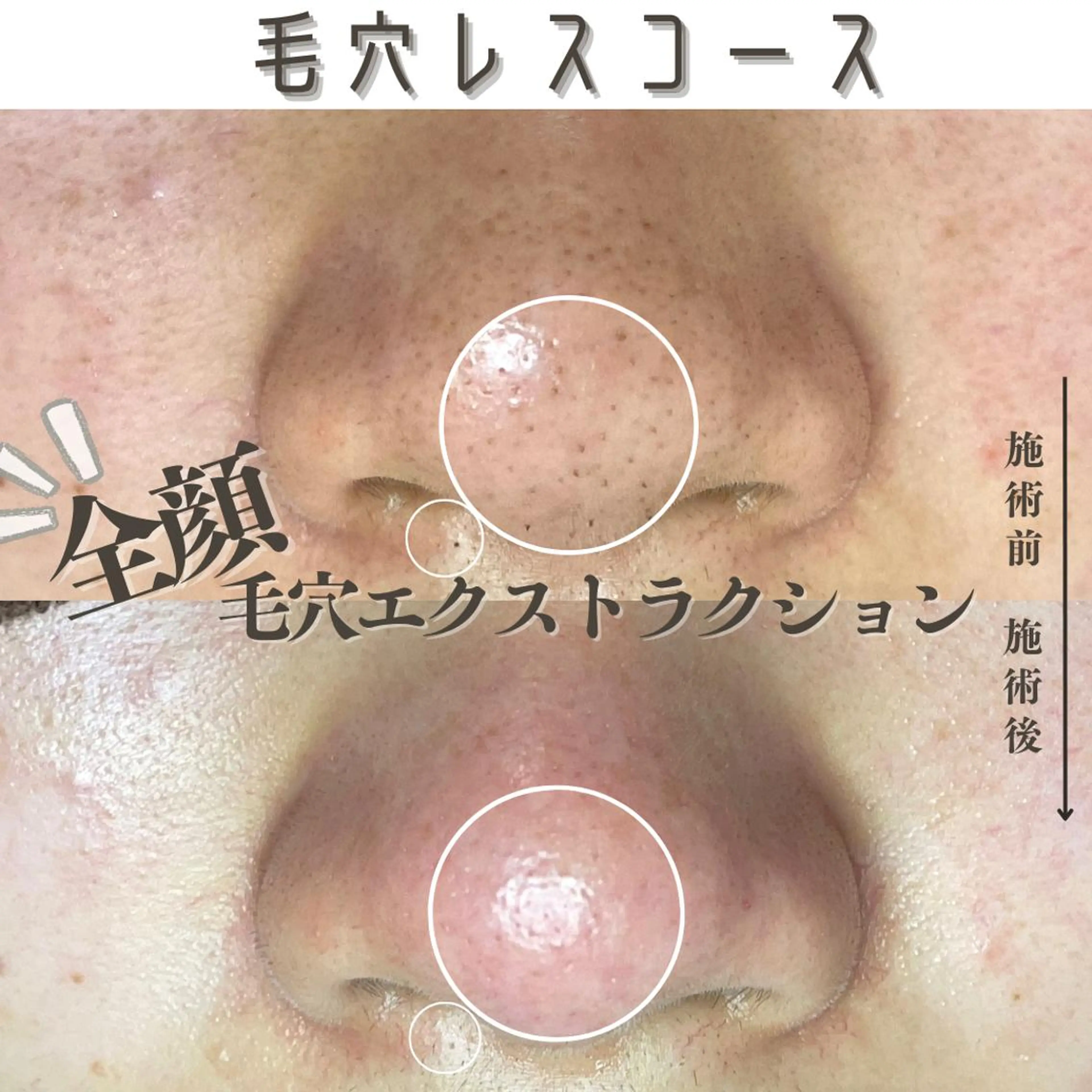 エステ Muqu. 毛穴サロンのエステ・リラクイメージ