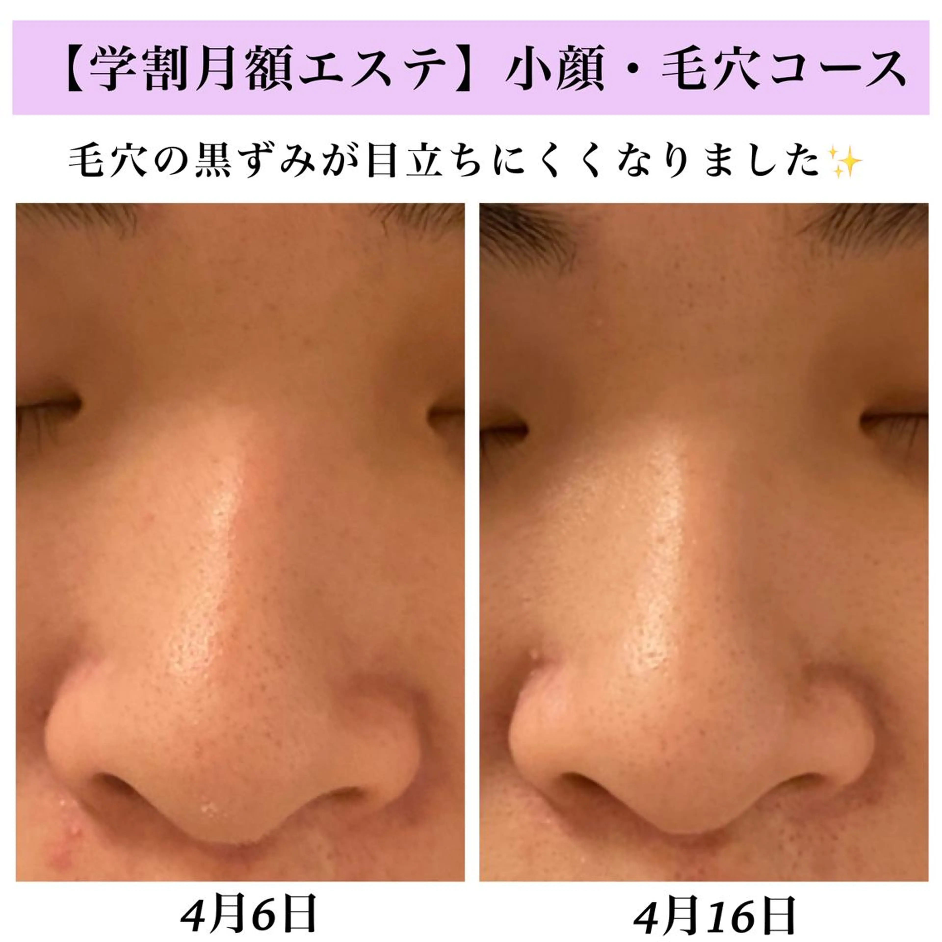 Bellesthe （ベルエステ）のエステ・リラクイメージ