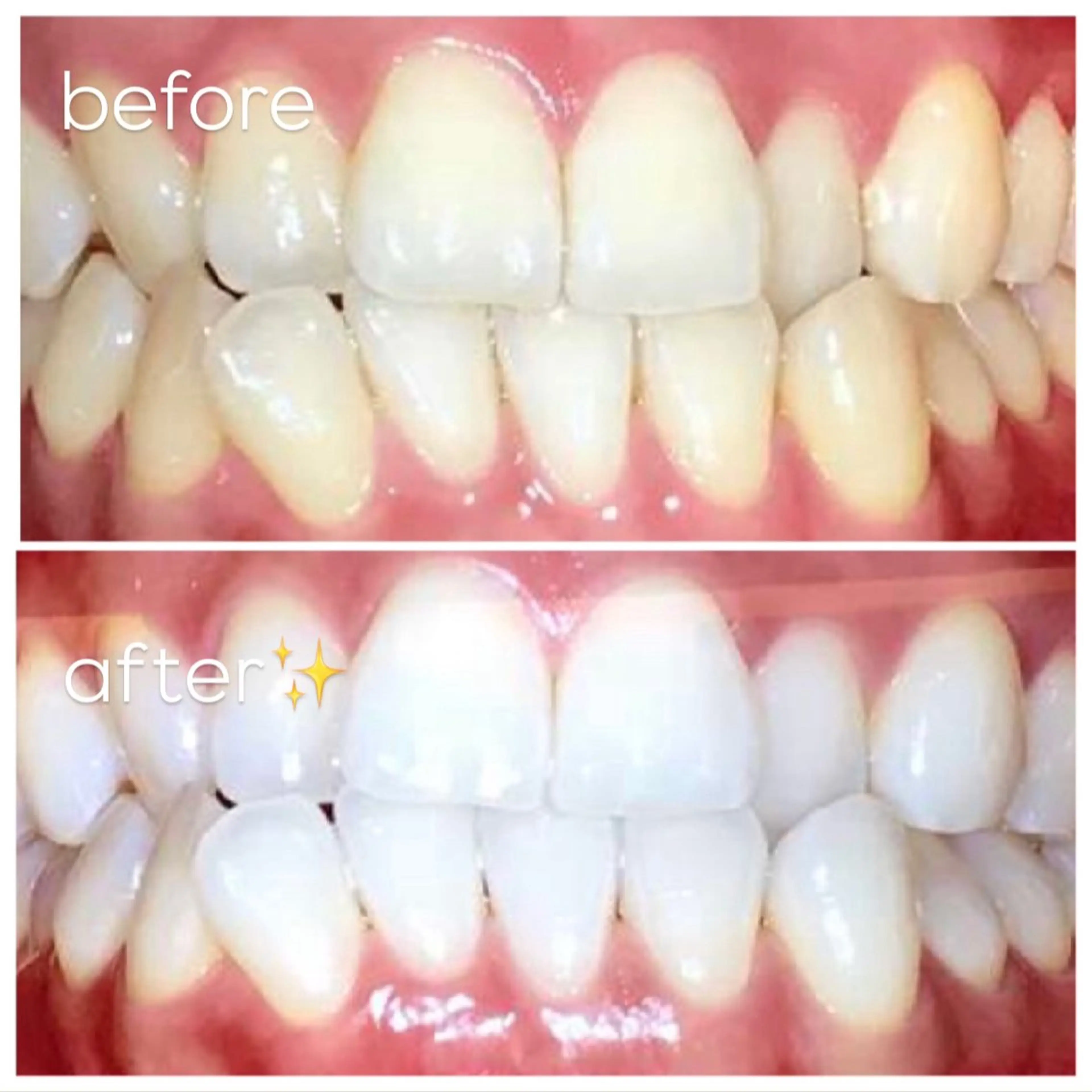 エクシア津駅前店所属・セルフホワイトニング エクシア津駅前店のその他イメージ