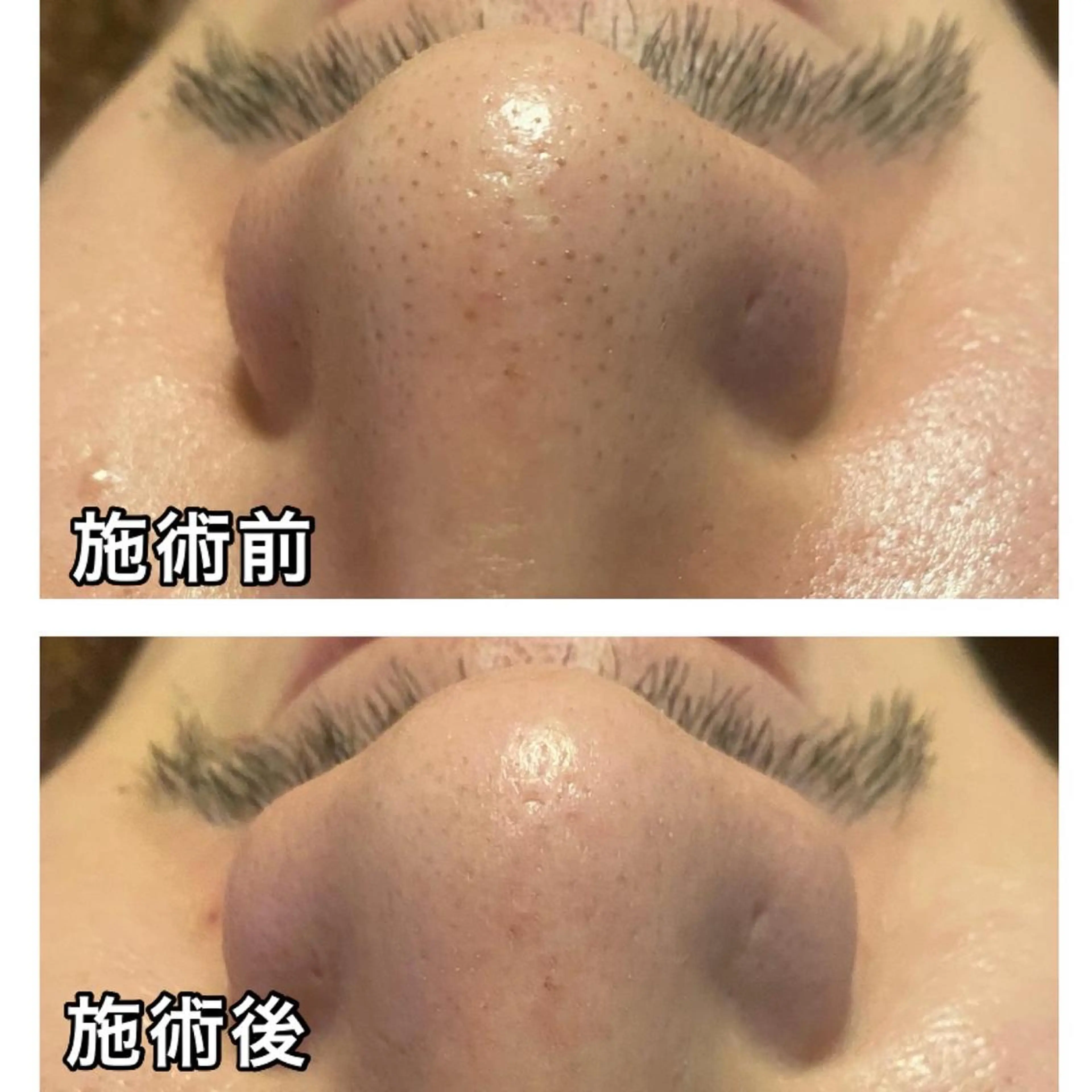 エステ リラク 🌴Beauty Salon LANAのエステ・リラクイメージ