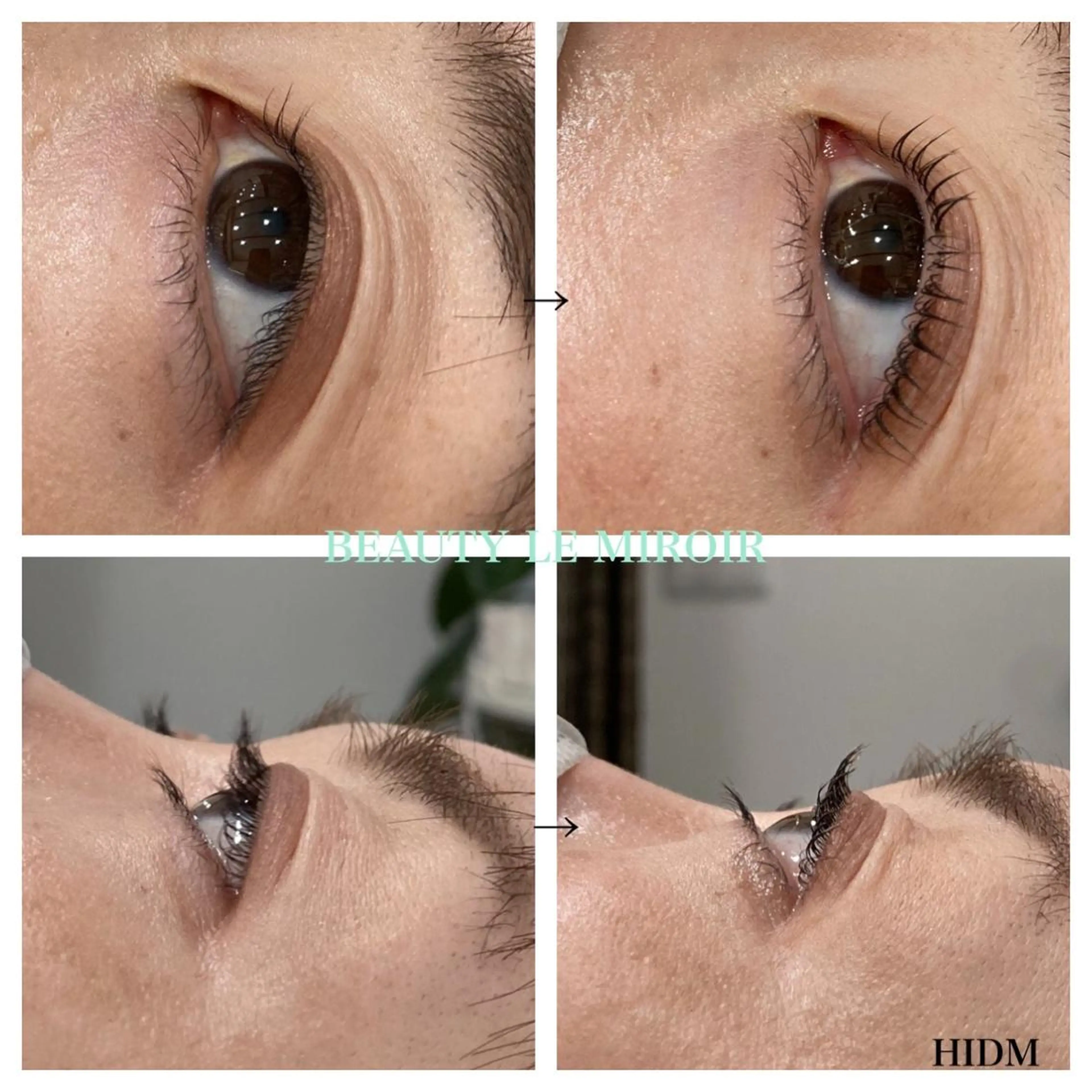 マツエク・マツパ ビューティー ミロワールのエステ・リラクイメージ