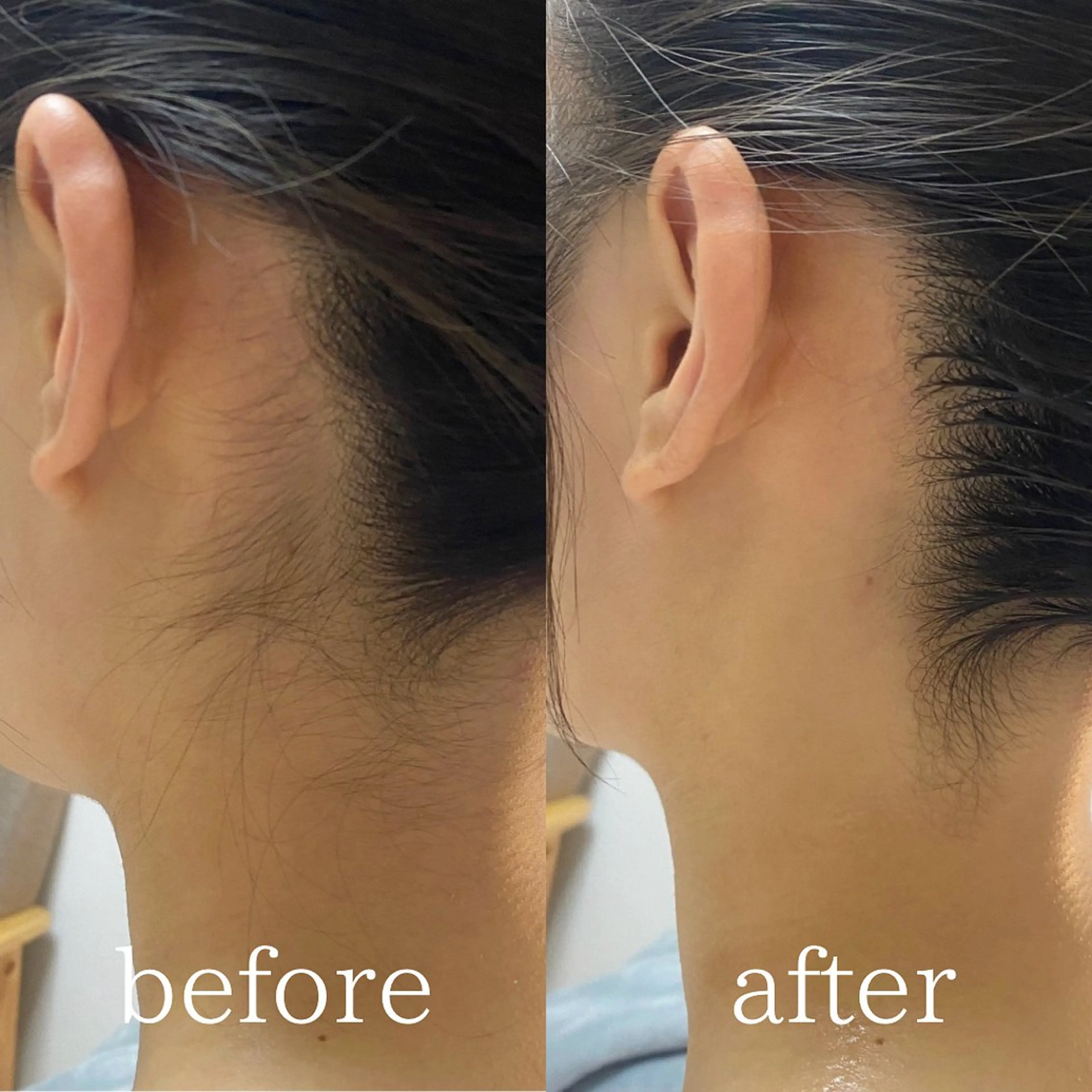 AKALA hitomiのエステ・リラクイメージ