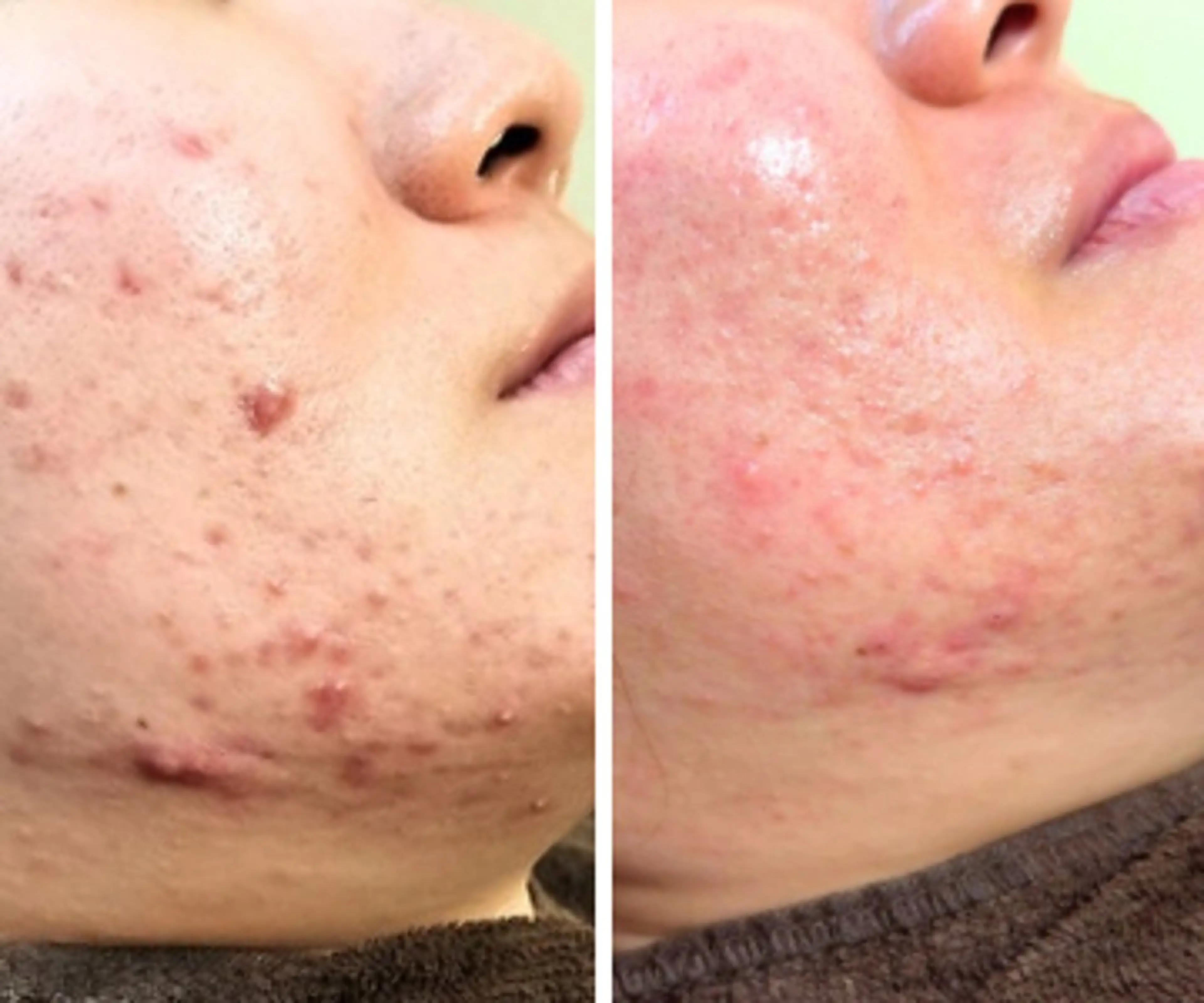 近藤 みさきのエステ・リラクイメージ