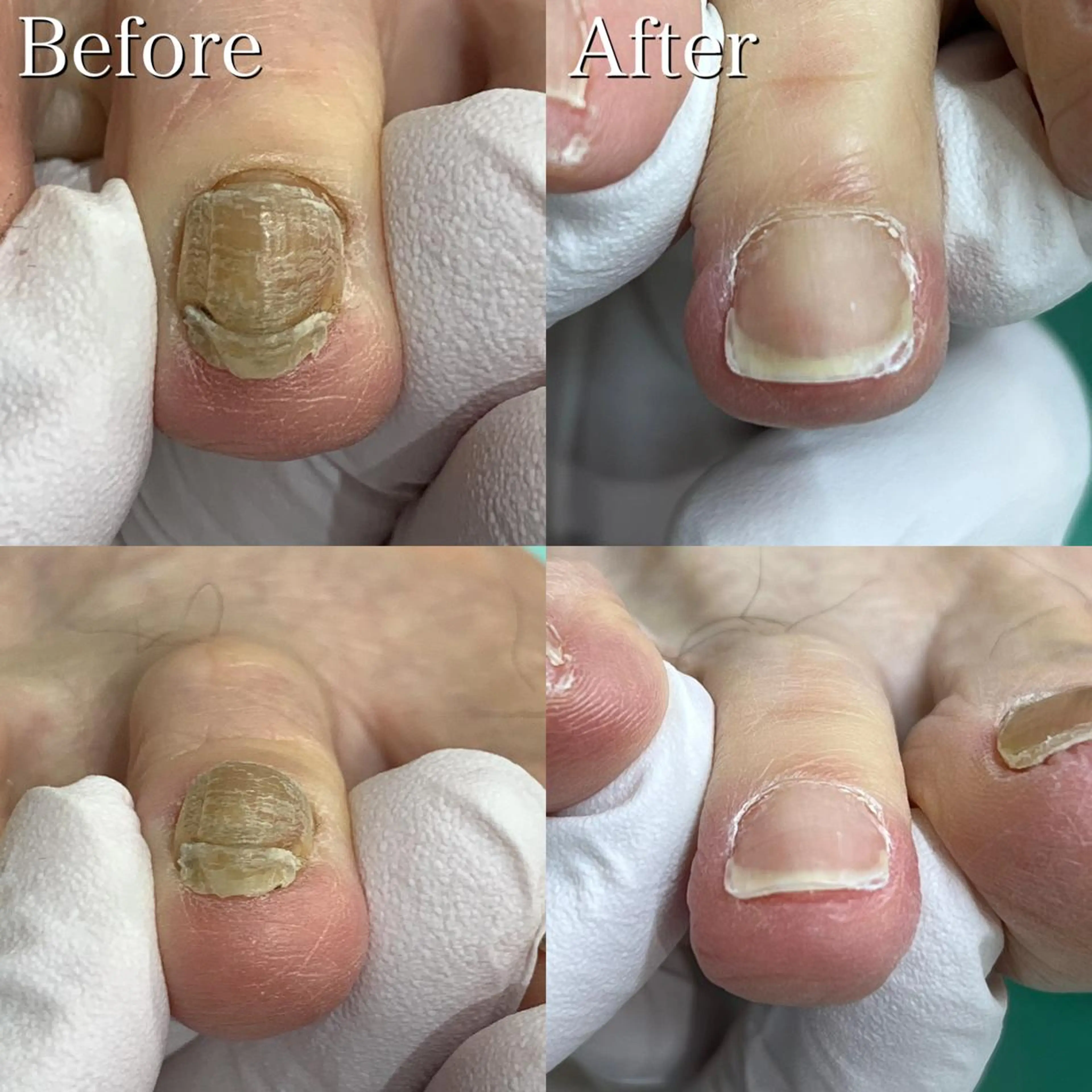 東京巻き爪 アカデミーのエステ・リラクイメージ