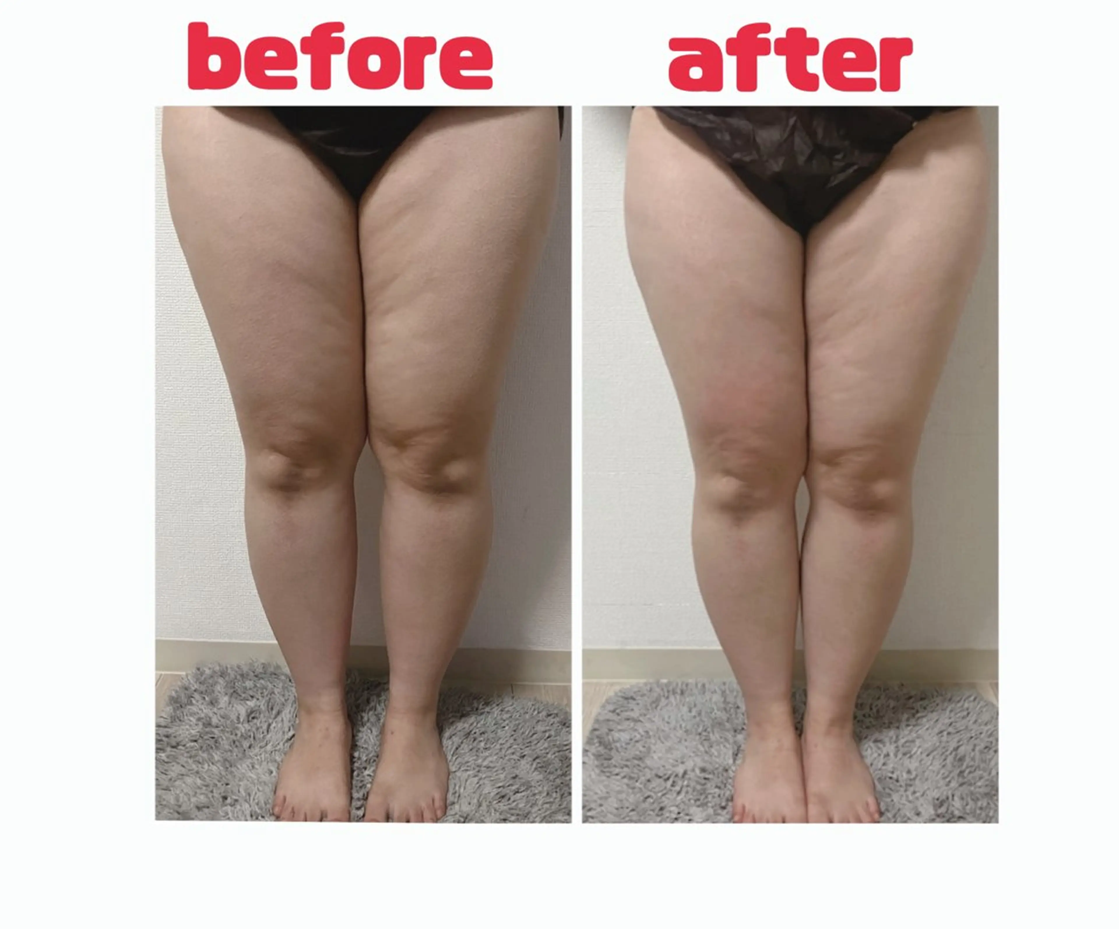 その他 くじらのしっぽ🐳 MISA🌺のエステ・リラクイメージ