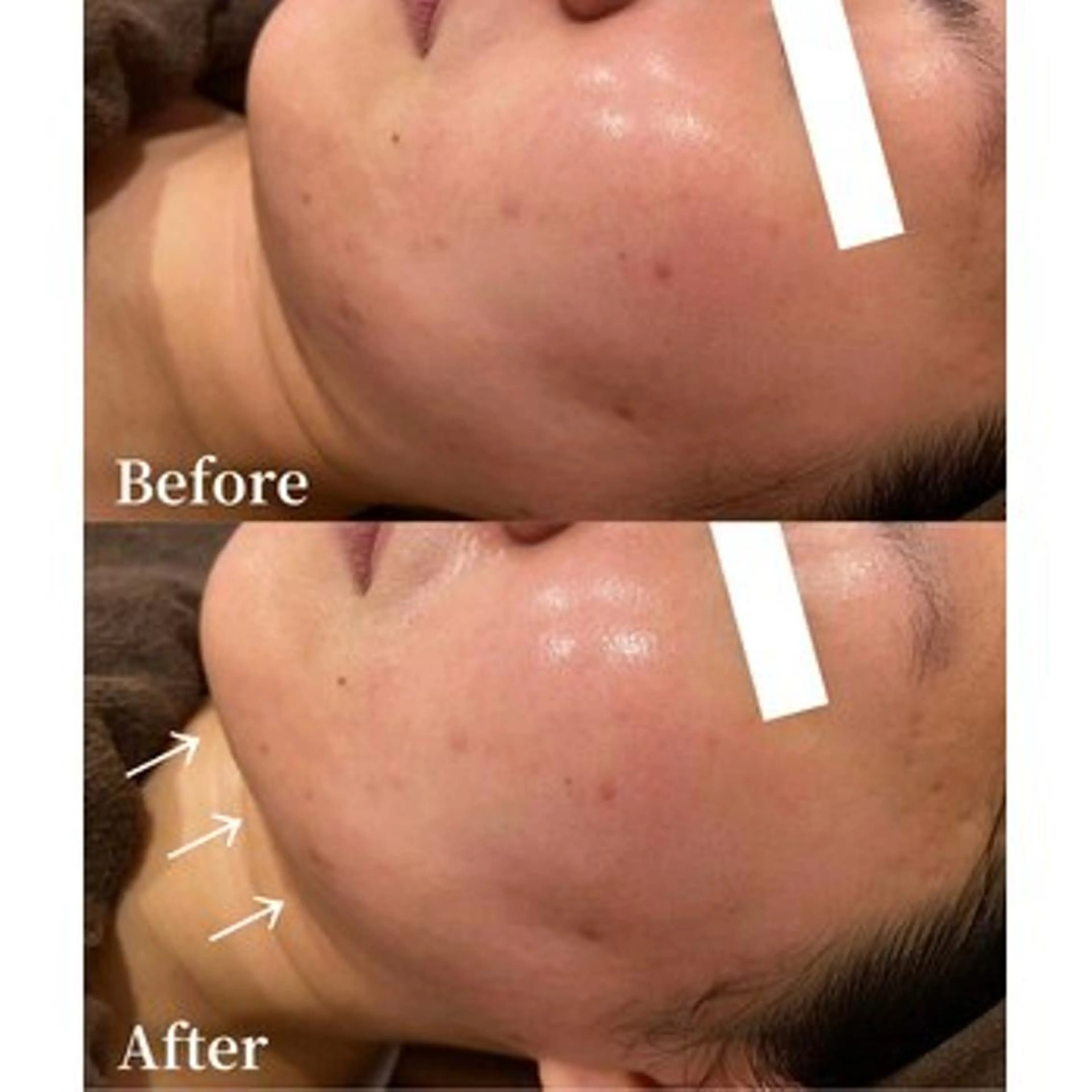 脱毛＆小顔；ミアンカ 京橋京阪モール店のエステ・リラクイメージ