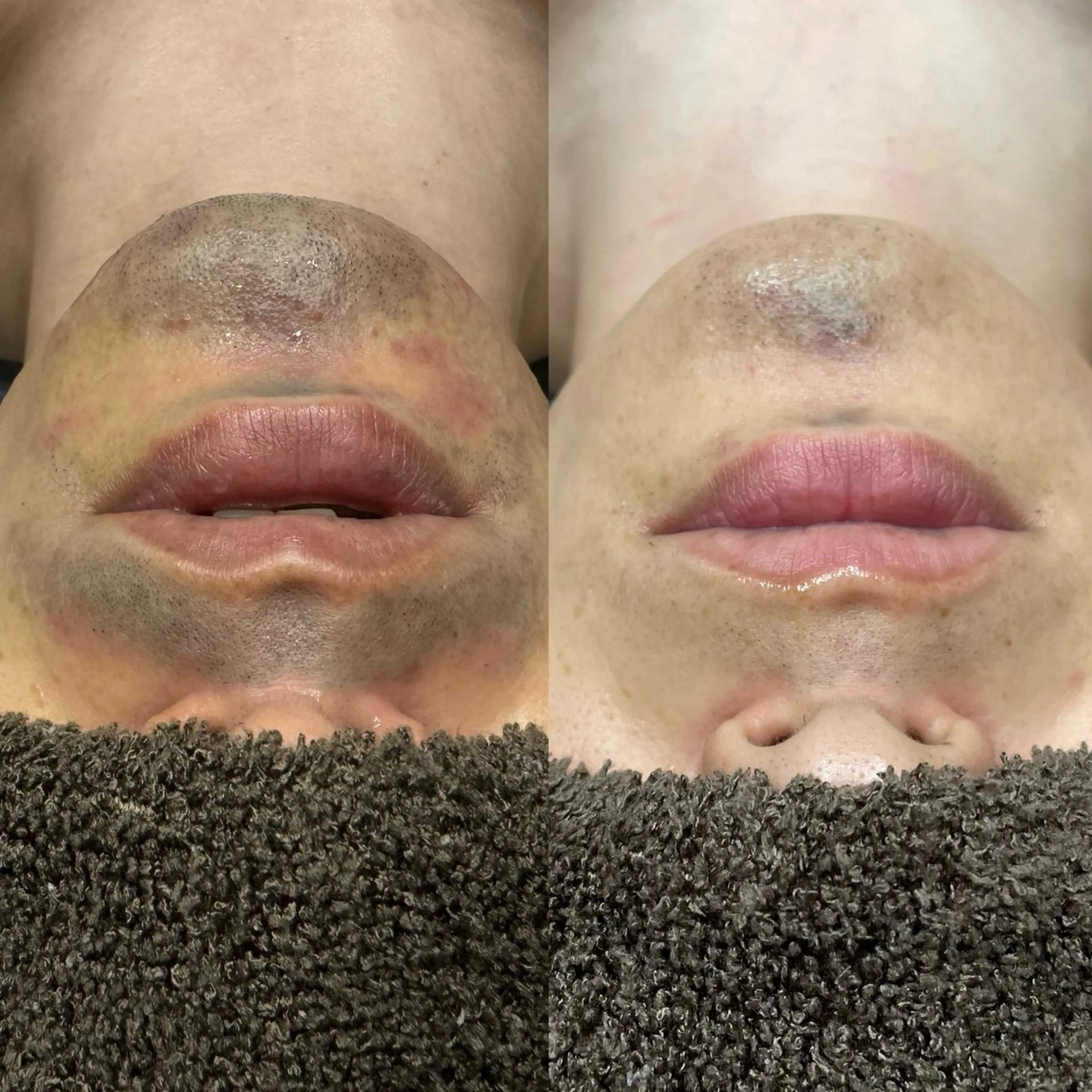 脱毛 高知駅前店　Tug AMIのその他イメージ