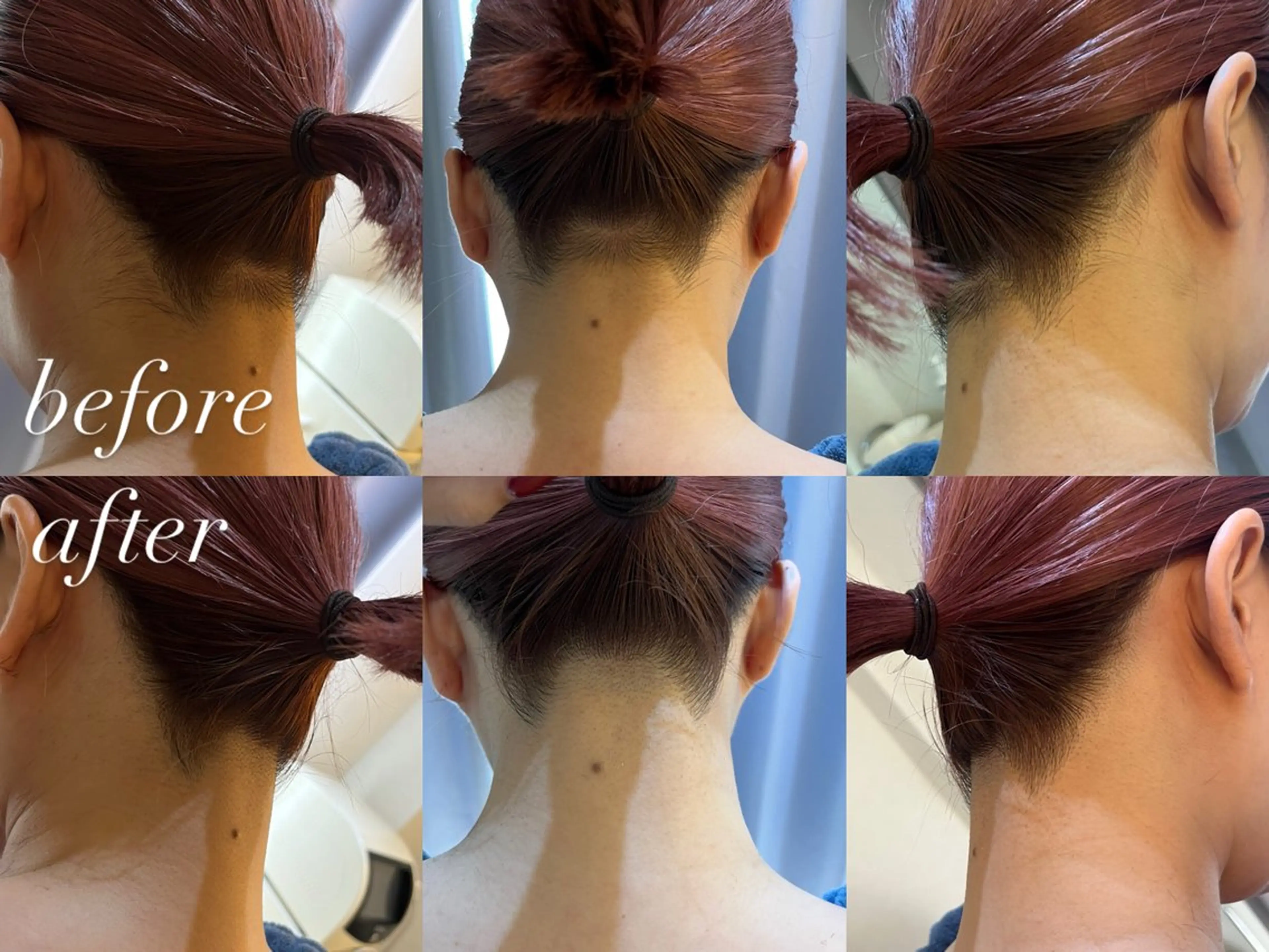 脱毛 うなじ脱毛/美肌脱毛 LABELのエステ・リラクイメージ