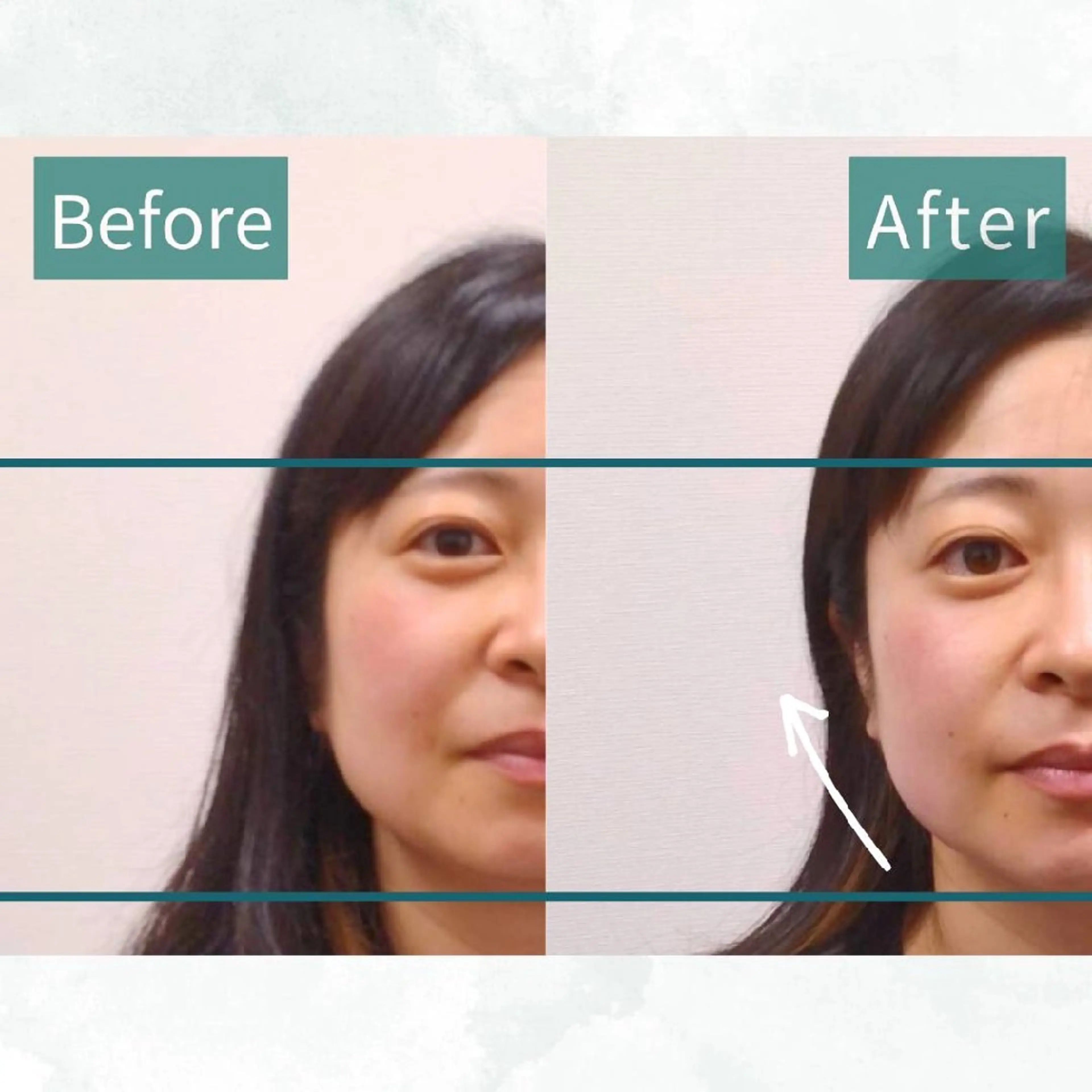 エステ リラク KANWA 鍼灸院のエステ・リラクイメージ